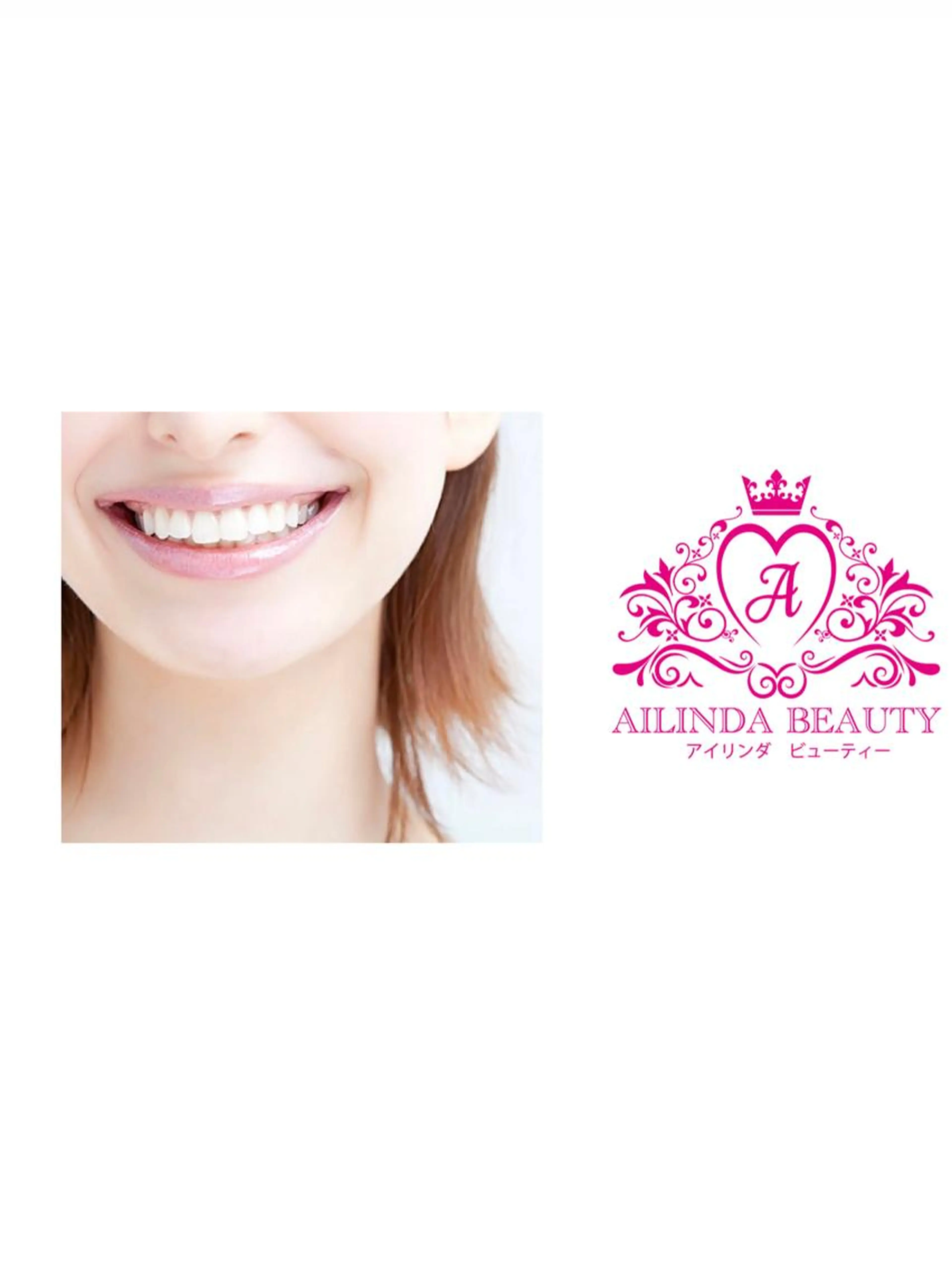 お試しホワイトニングの写真