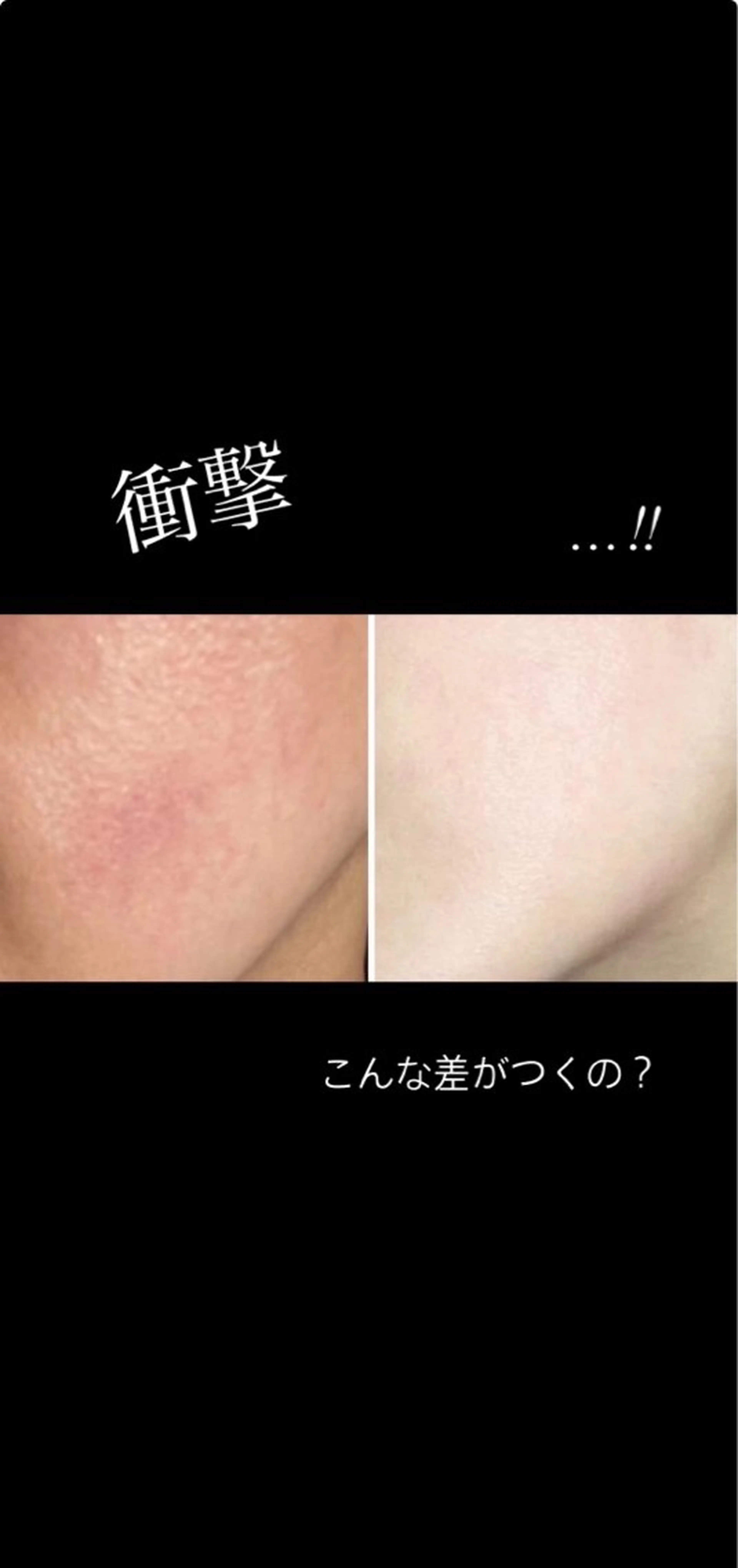 半田市エステサロン　シェソワ所属・肌荒れ/疲れケア シェソワのエステ・リラクイメージ