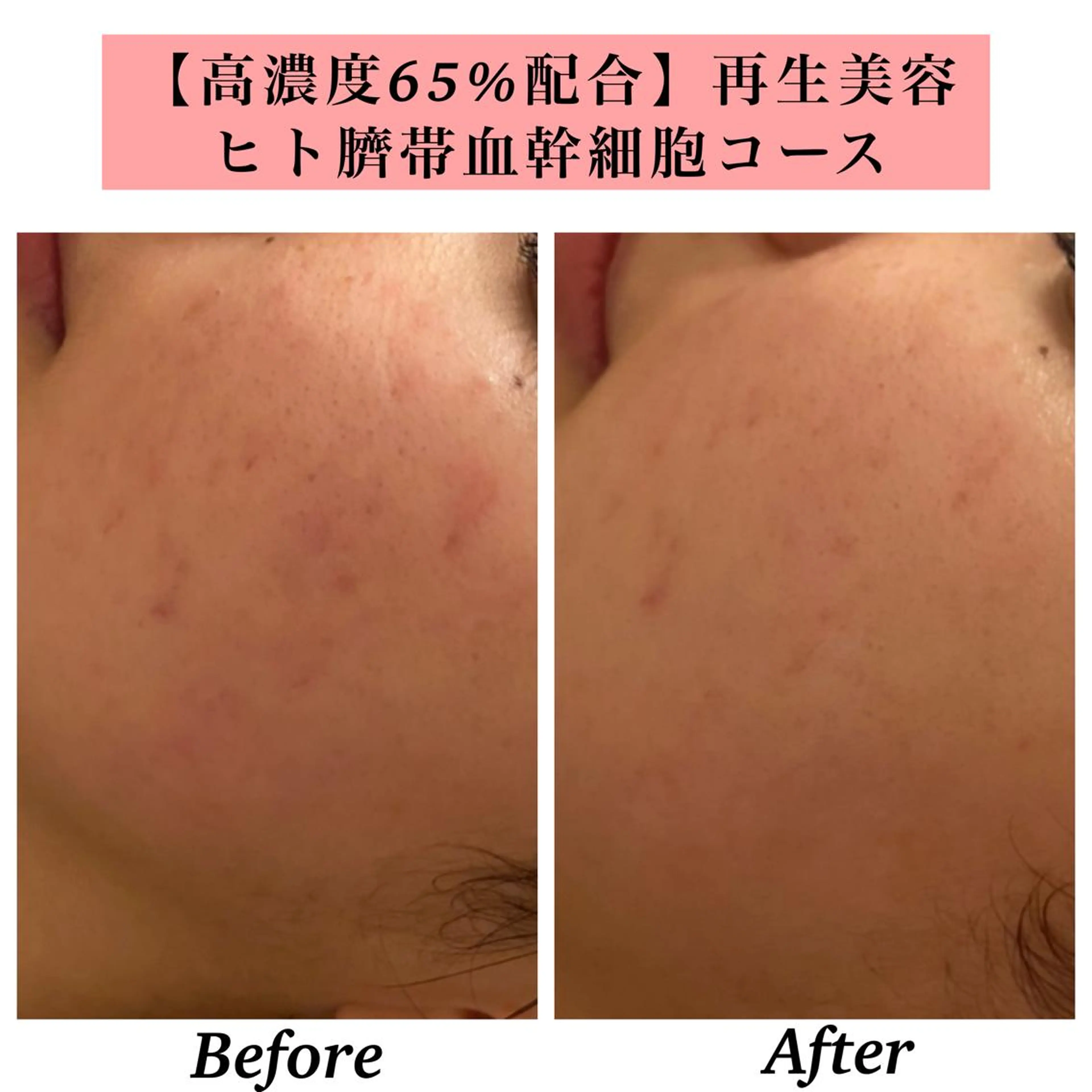 エステ リラク Bellesthe （ベルエステ）のエステ・リラクイメージ