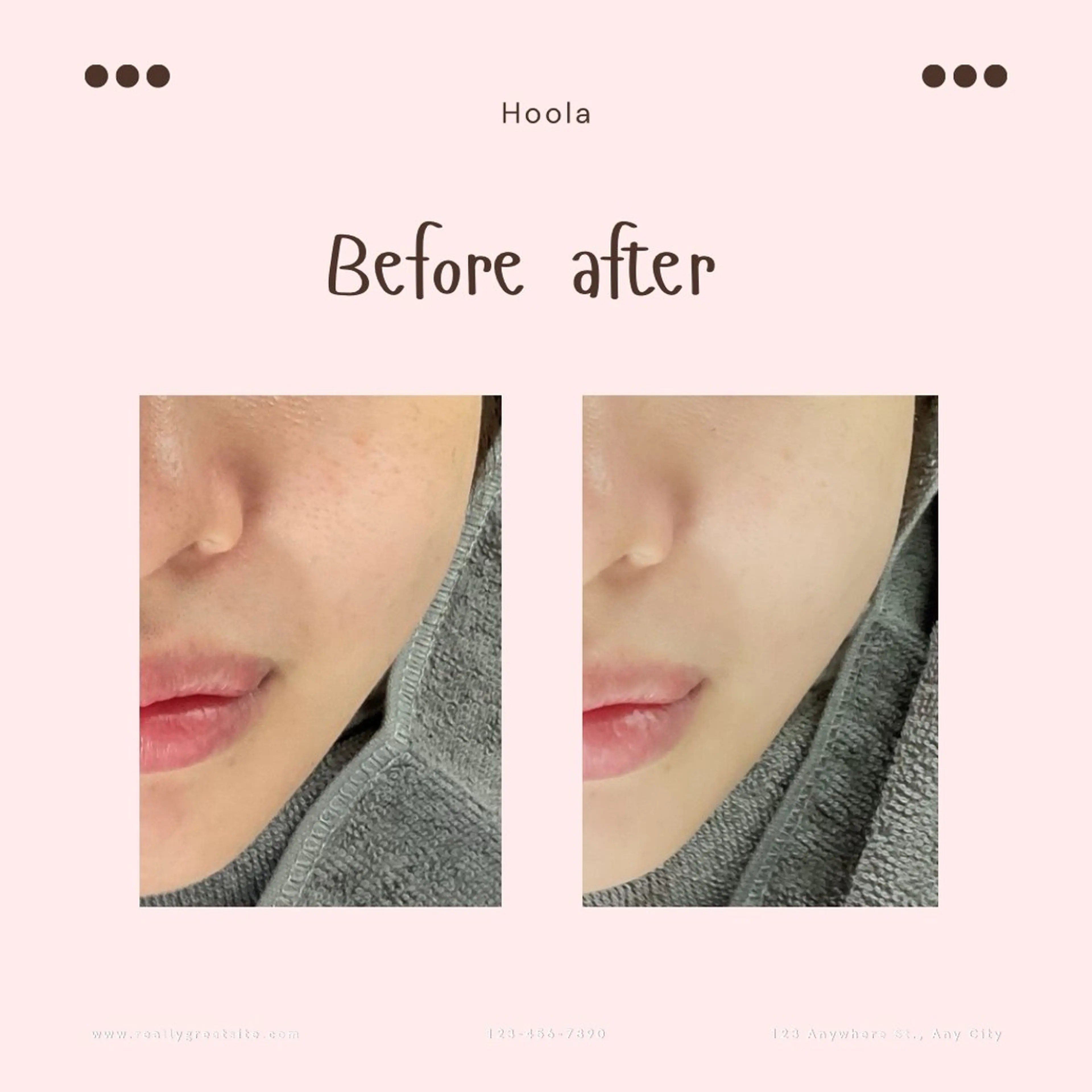 ハーブピーリング 〜Hoola〜のエステ・リラクイメージ