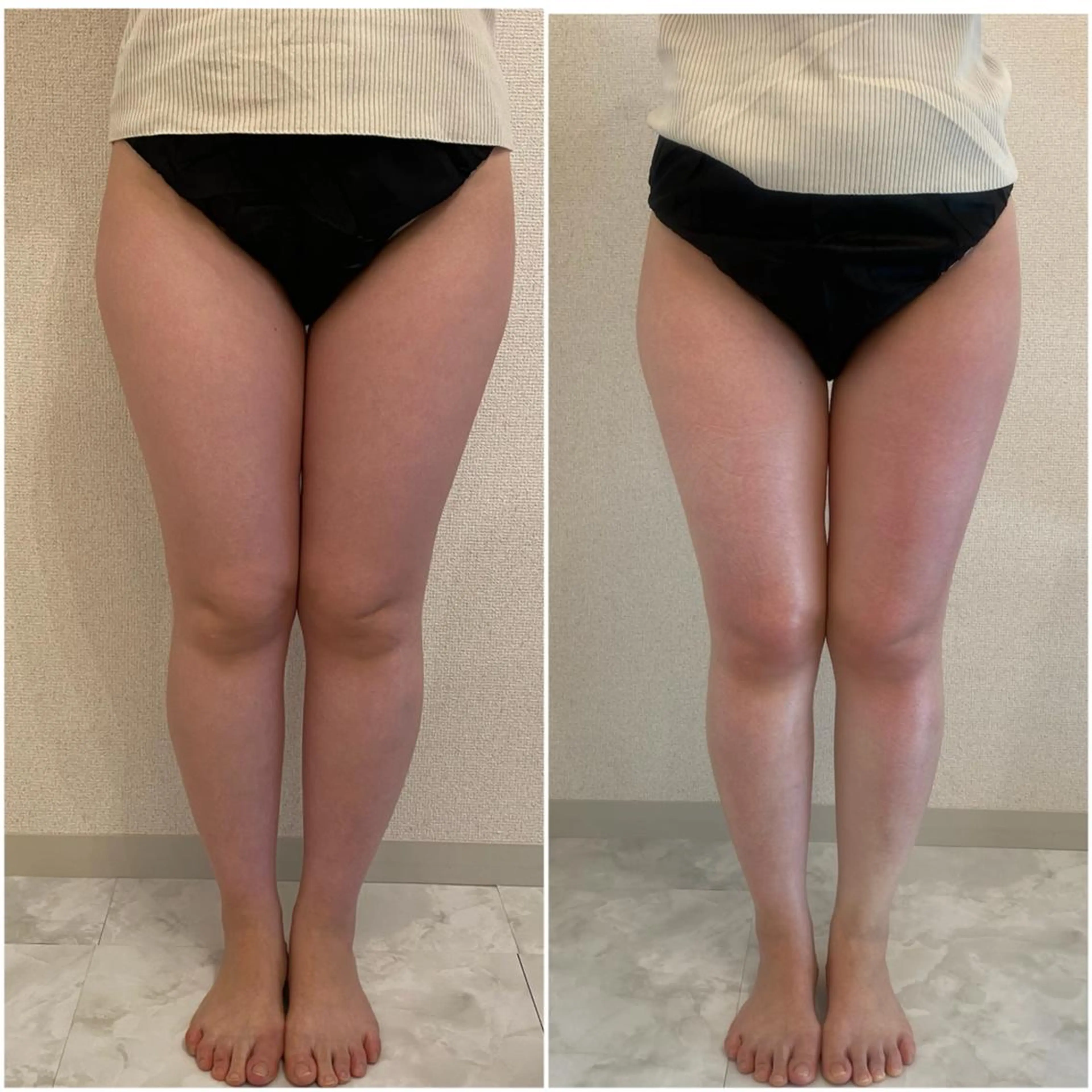 ✨美肌水光✨ アトリエリュバンのエステ・リラクイメージ