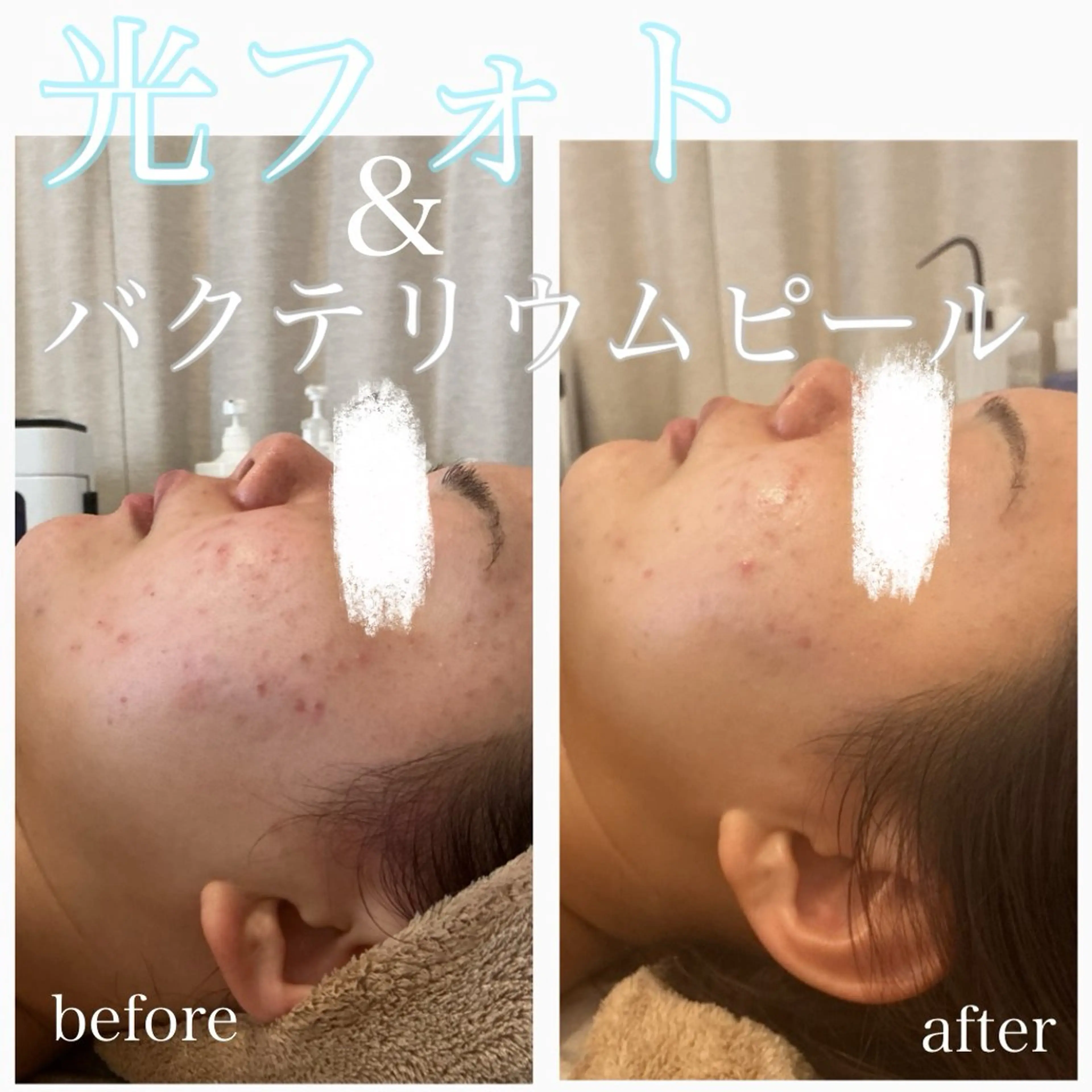 美肌脱毛と癒しのﾌﾟﾗｲﾍﾞｰﾄｻﾛﾝ。gratia~ｸﾞﾚｲﾃｨｱ~所属・gratia ~ｸﾞﾚｲﾃｨｱ~のエステ・リラクイメージ