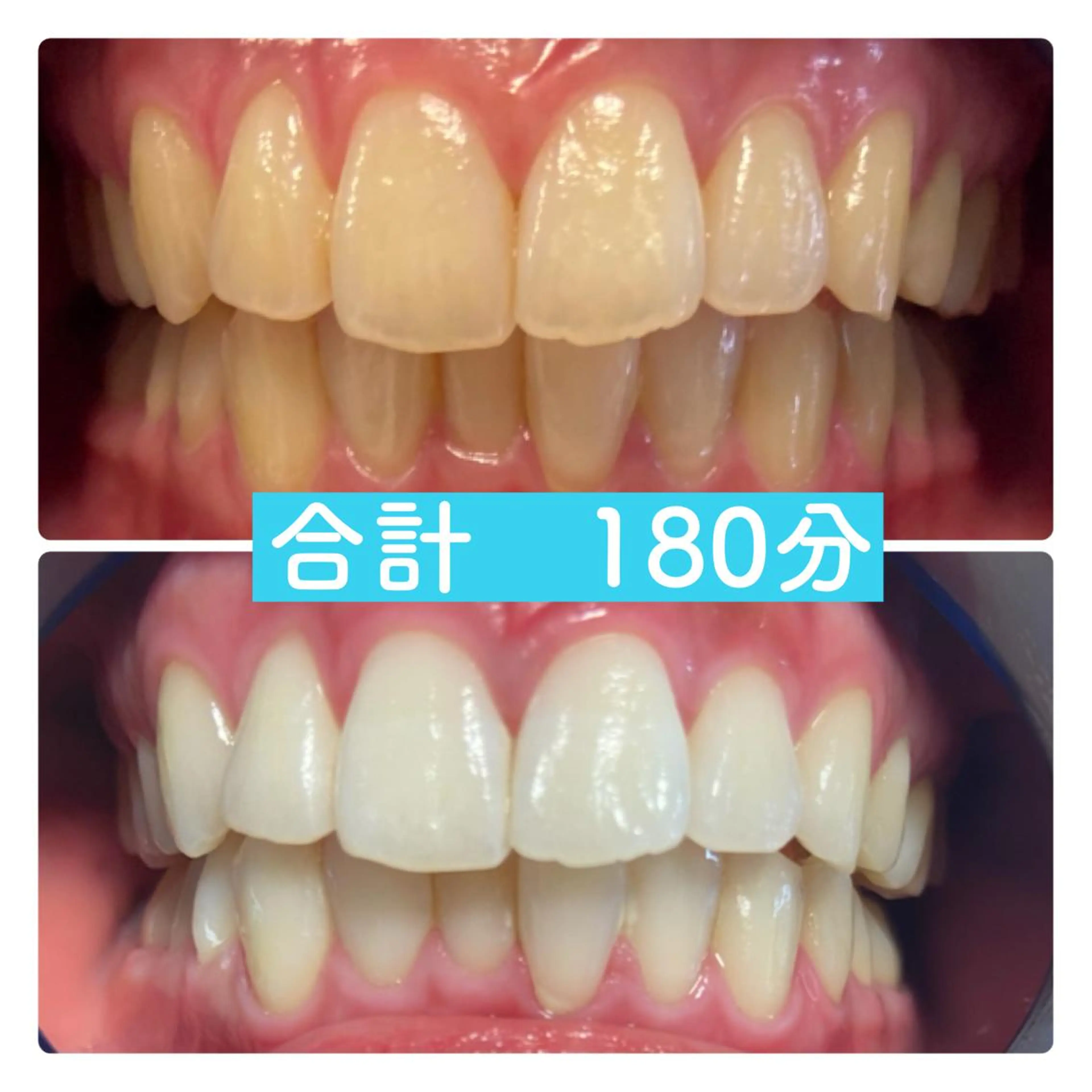 その他 PLATINUM Beauty 横浜店所属・ホワイトニングルーム 横浜店のその他イメージ