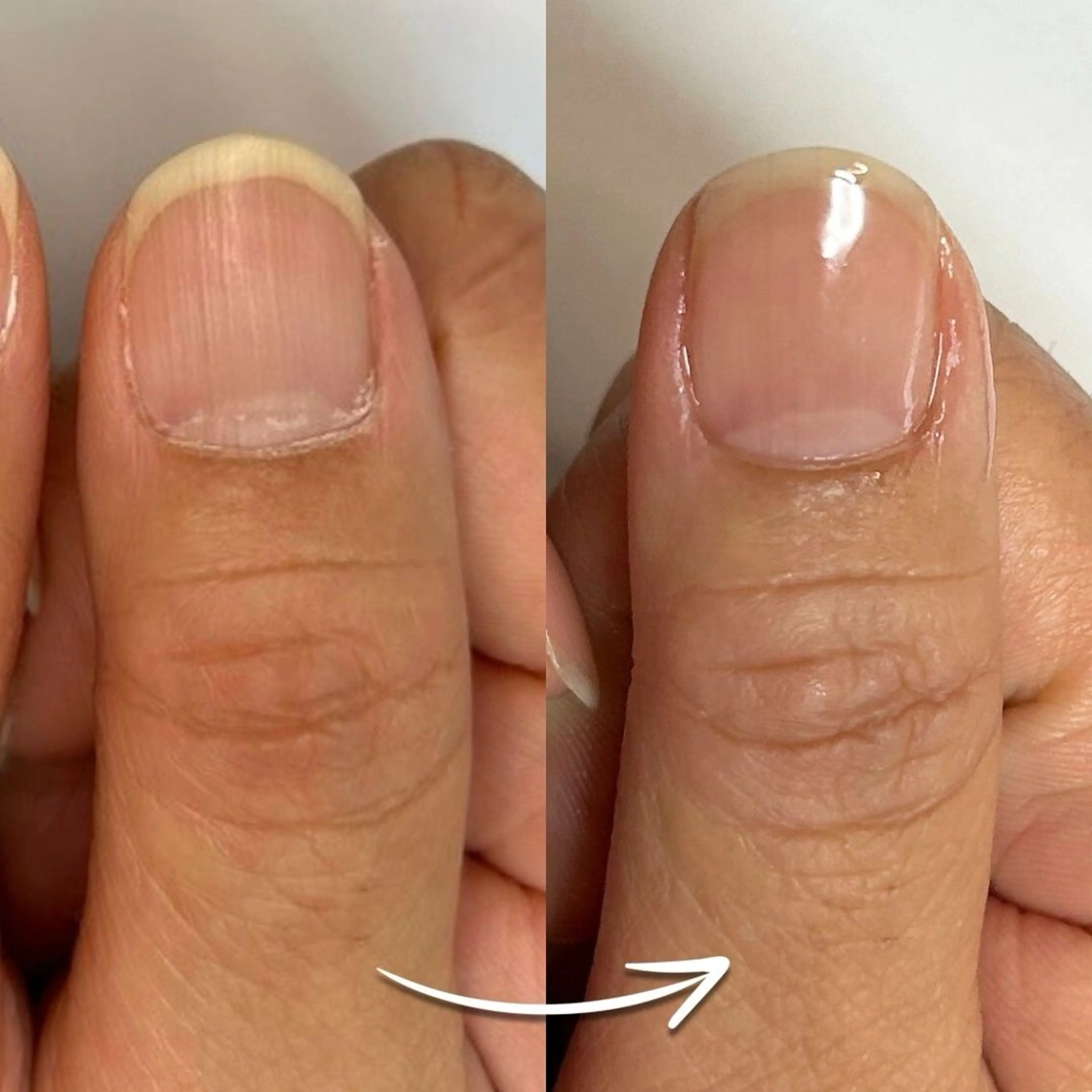 ネイル クリアネイル ジェルネイル Tolano nailcareのネイルデザイン