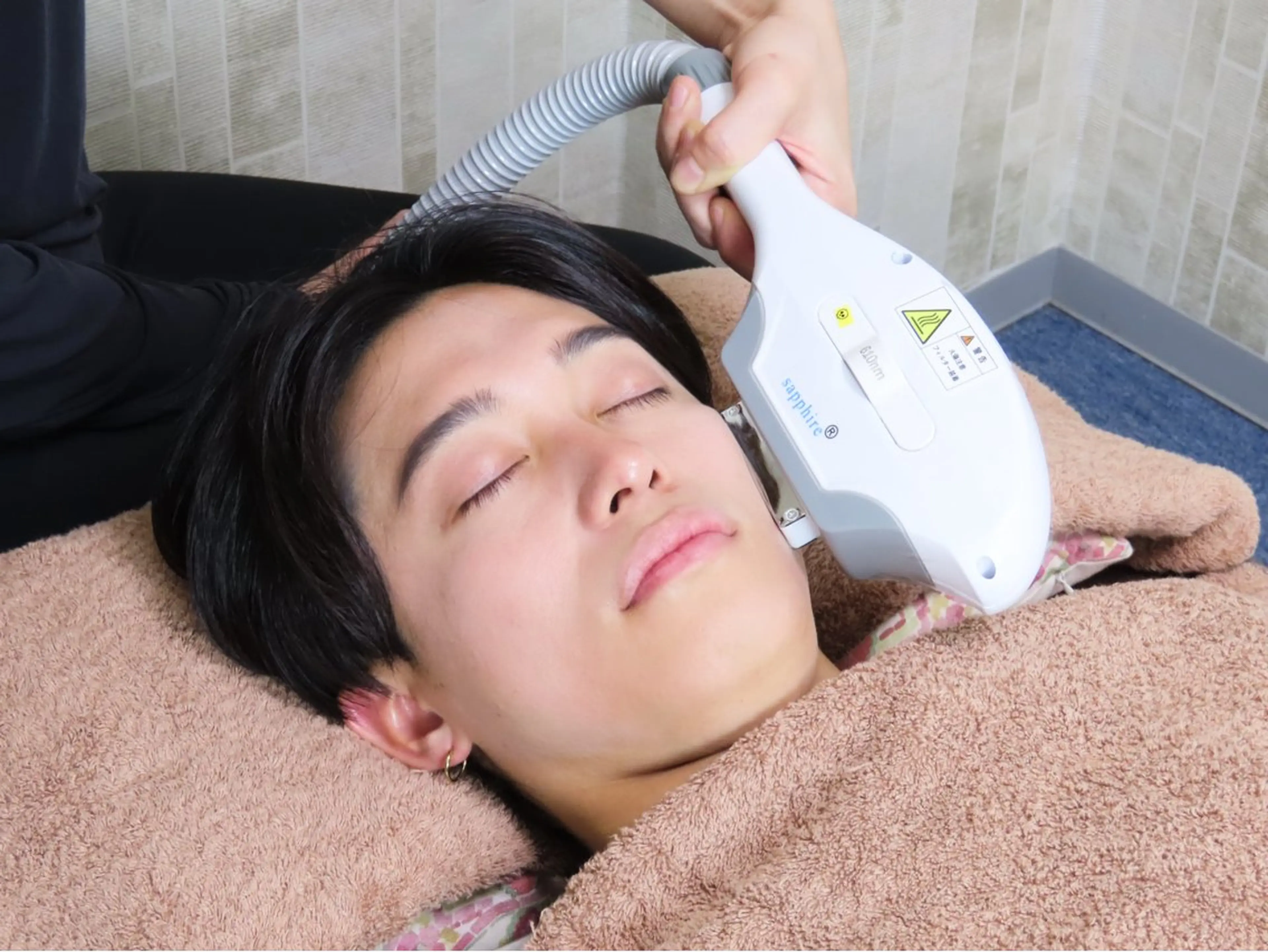 髭脱毛　（メンズのみ）の写真