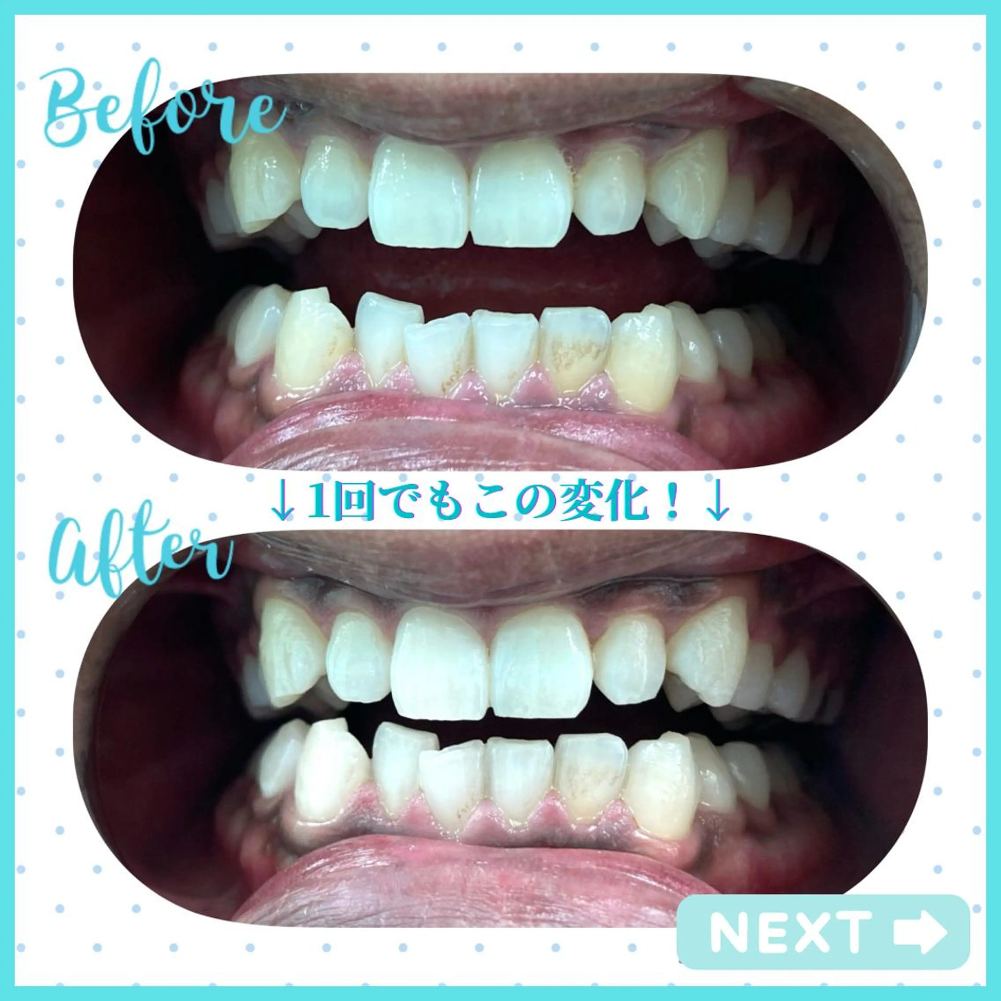 セルフホワイトニングCOCOSHIRO所属・セルフホワイトニング COCOSHIROのエステ・リラクイメージ