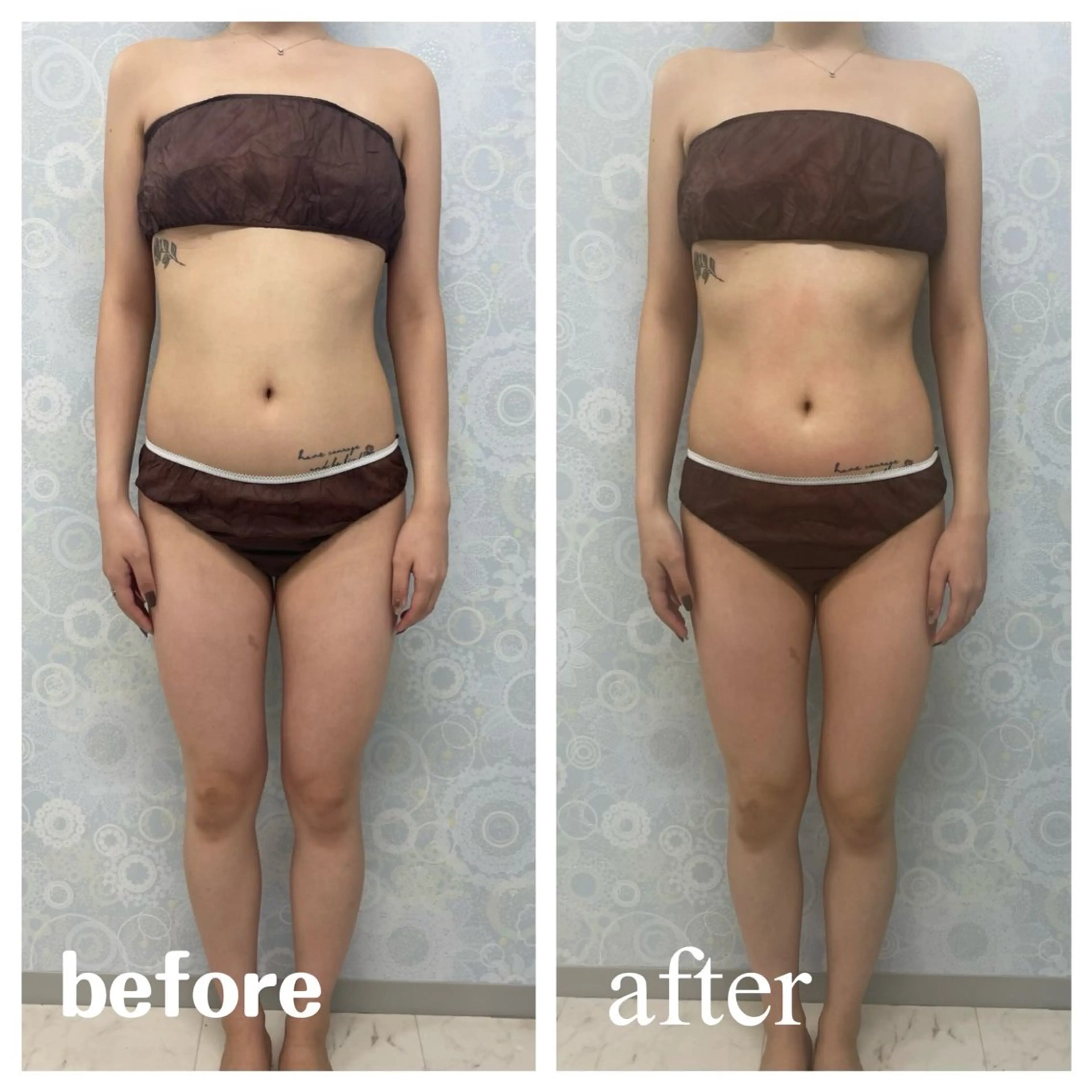 エステ miin所属・新小岩beauty saron miinのエステ・リラクイメージ