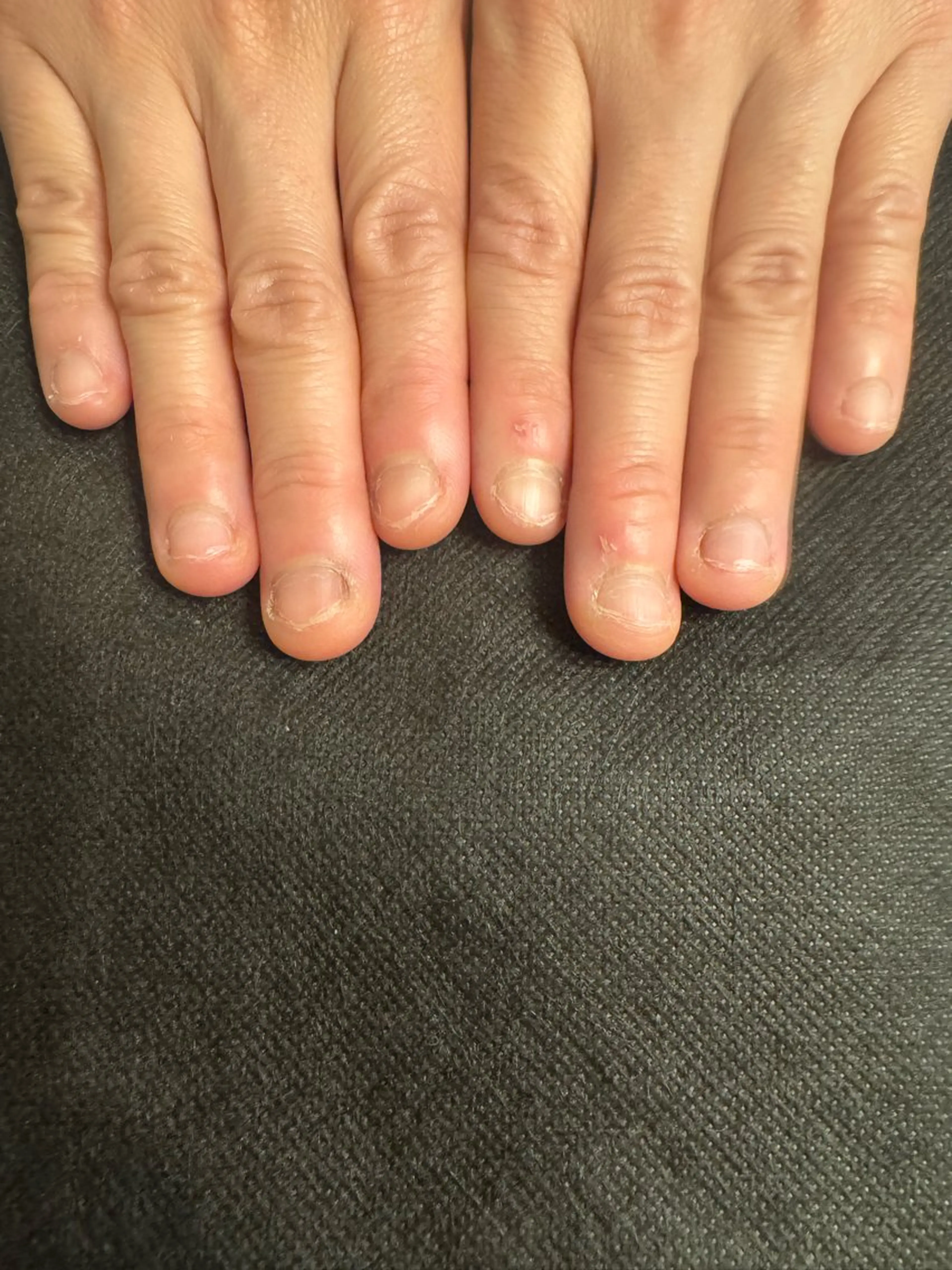 ネイル 美容爪クリニックサロン所属・美容爪 クリニックサロンのネイルデザイン