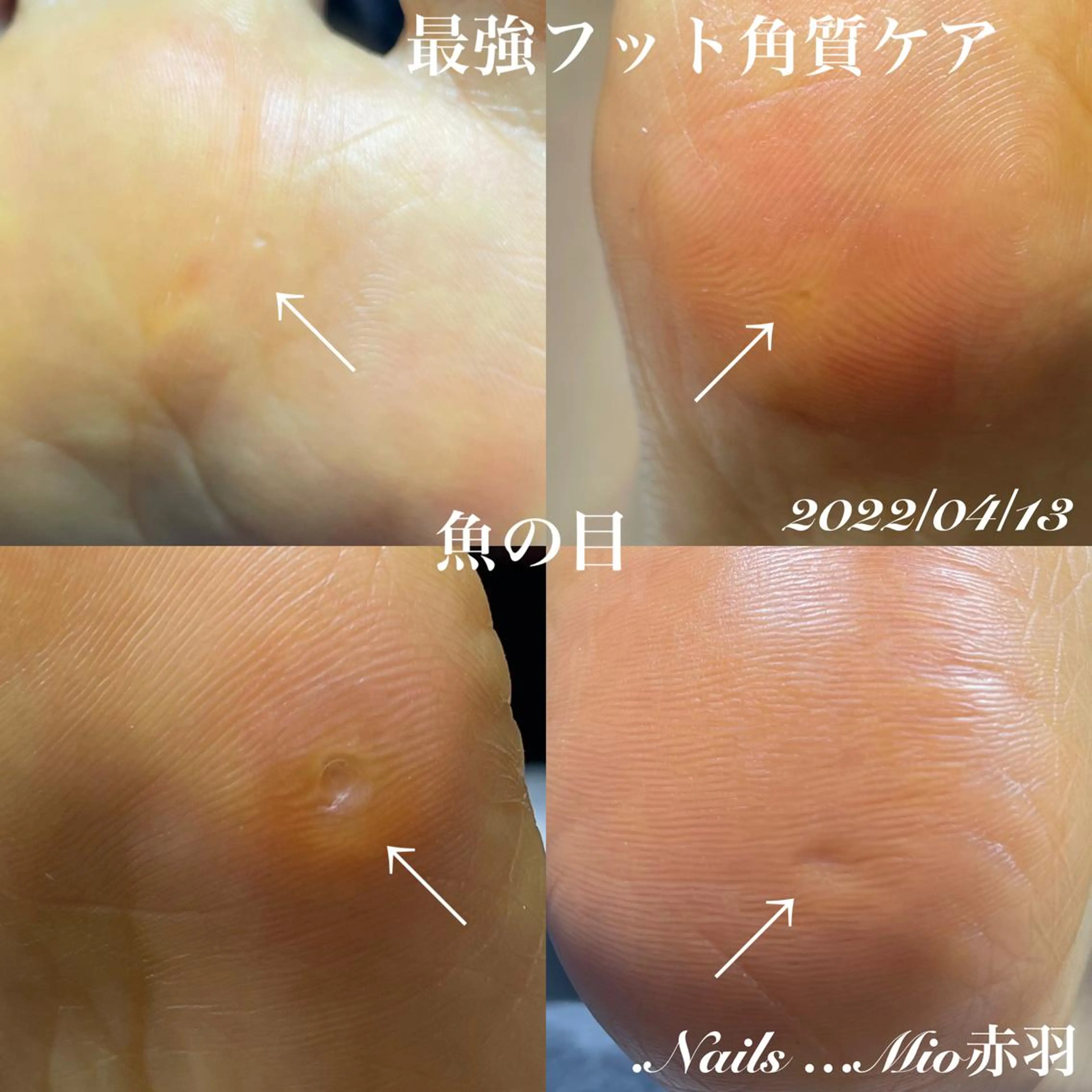 ネイル フットネイル .Nails Mio 赤羽西ネイルサロンのネイルデザイン