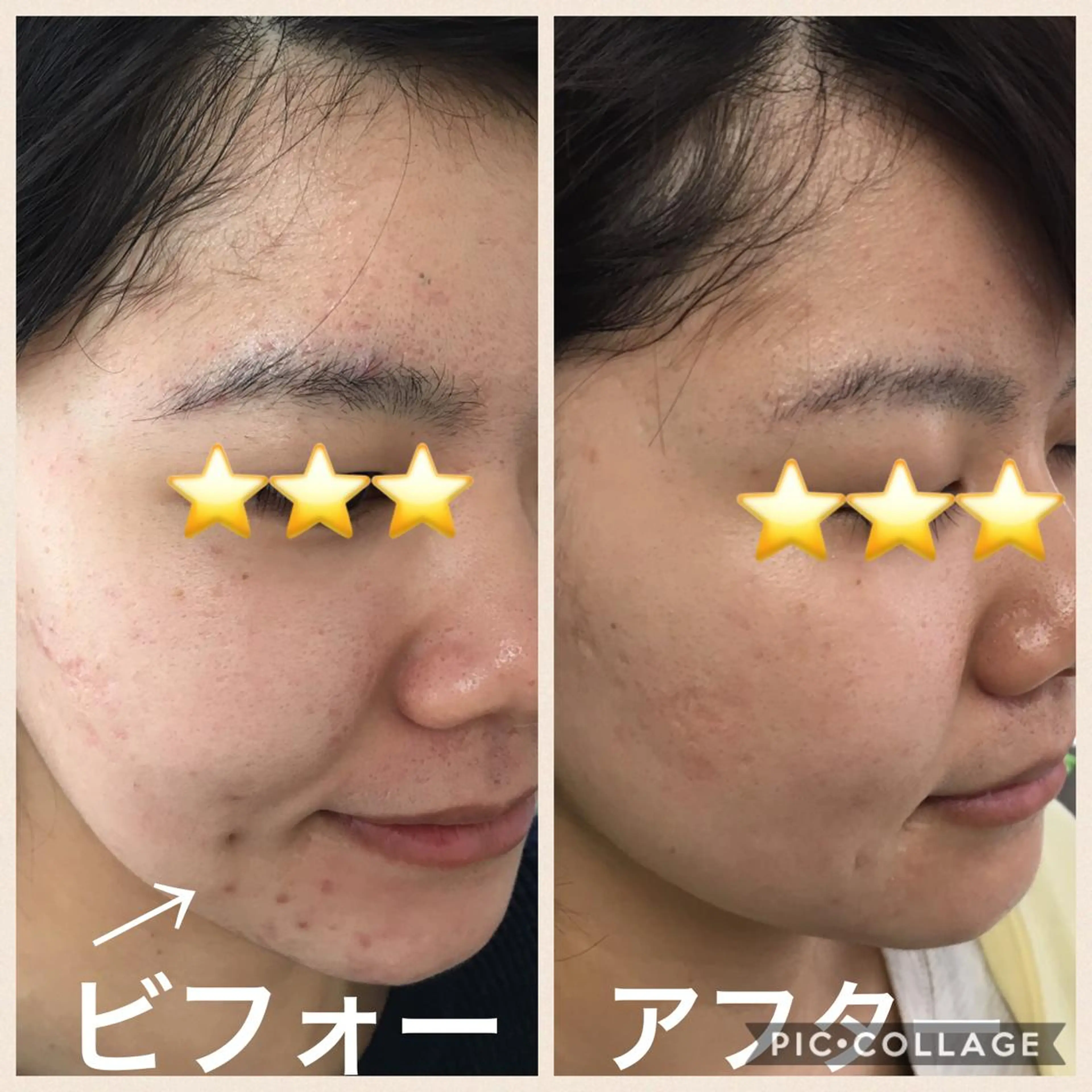 エステ DeI'm   名古屋栄所属・小林 玲菜のエステ・リラクイメージ