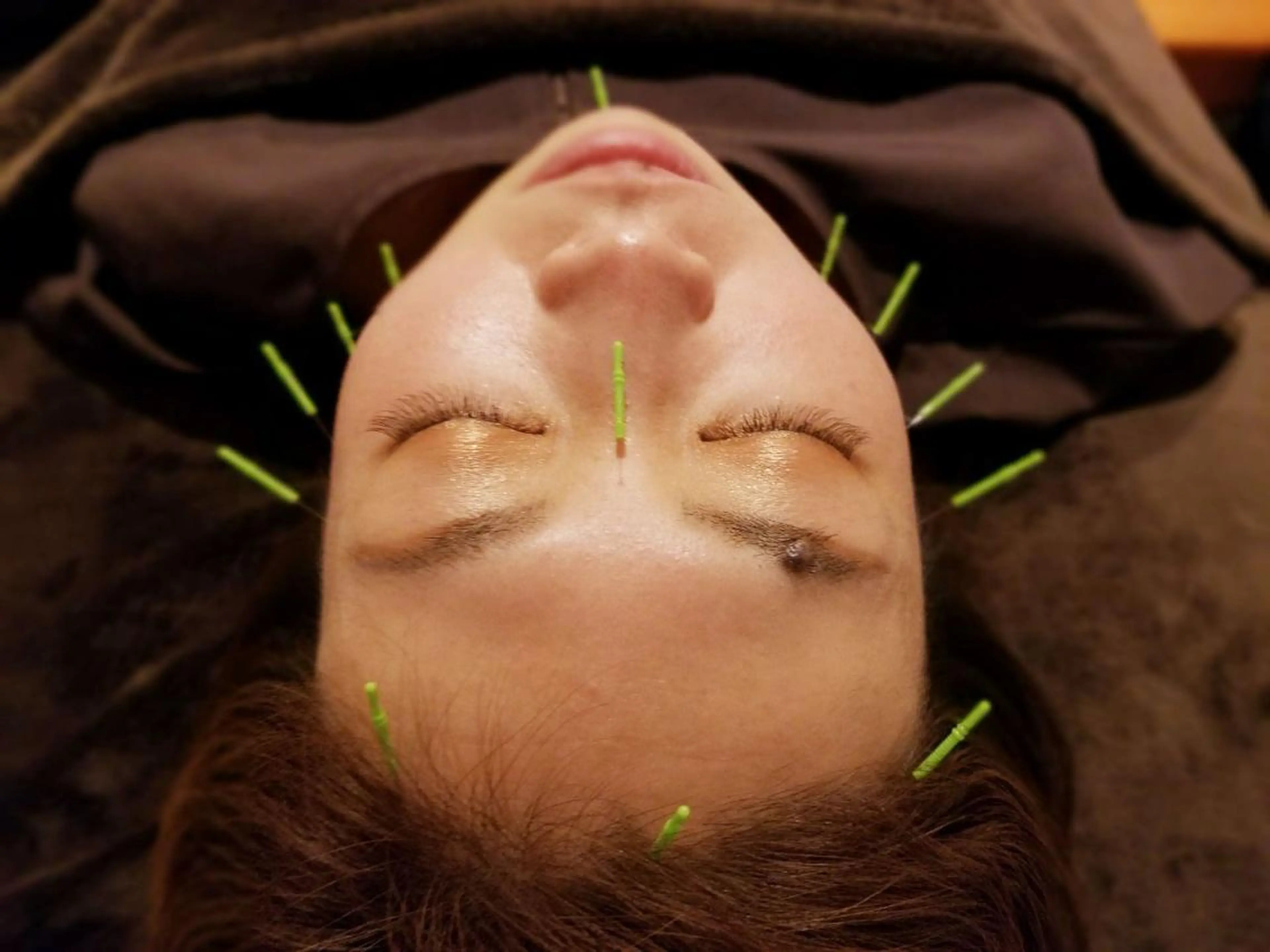 整体×美容鍼灸 鍼灸師Miyanoのエステ・リラクイメージ