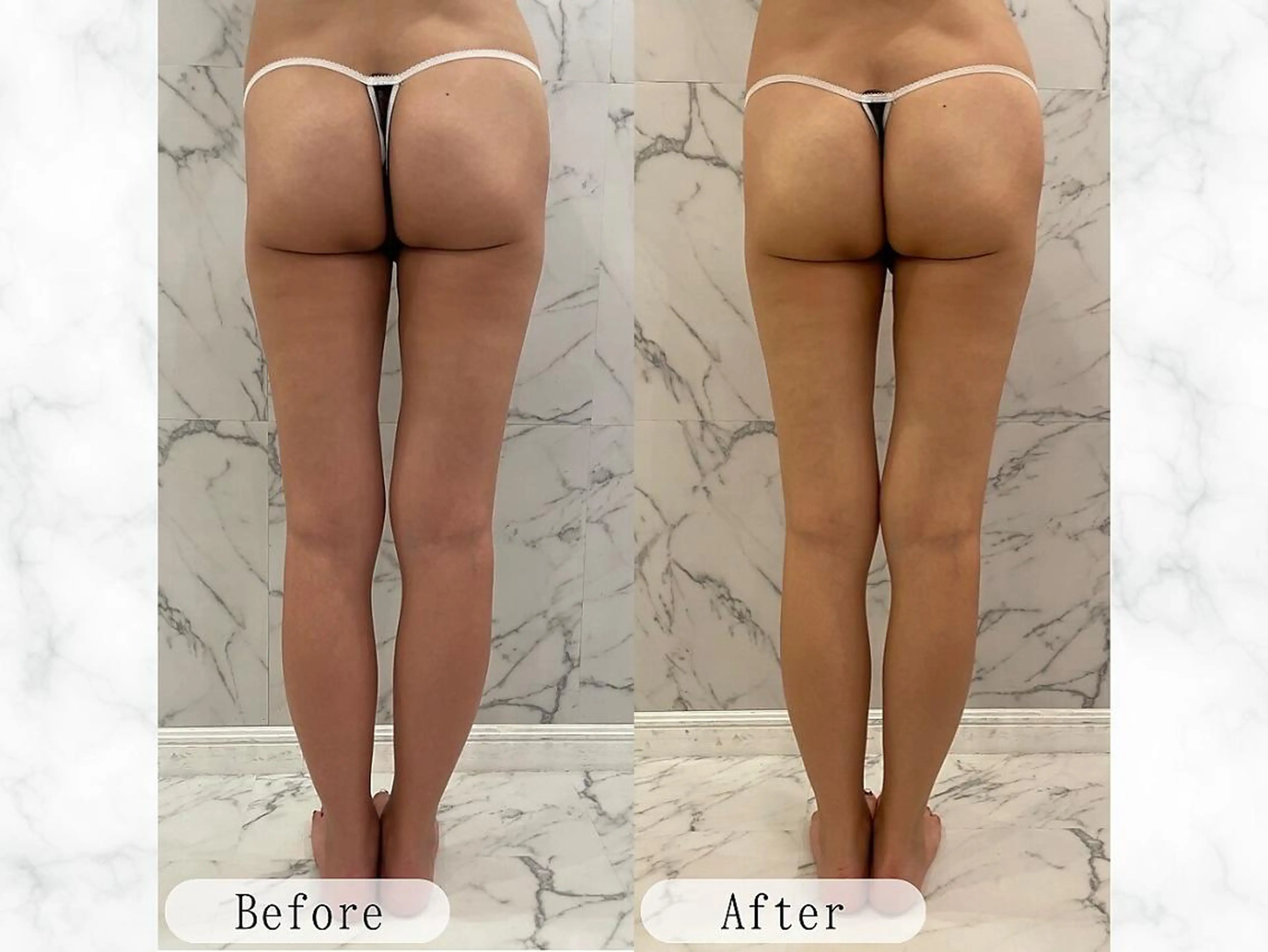 エステ バストアップサロン Lulumiliのエステ・リラクイメージ