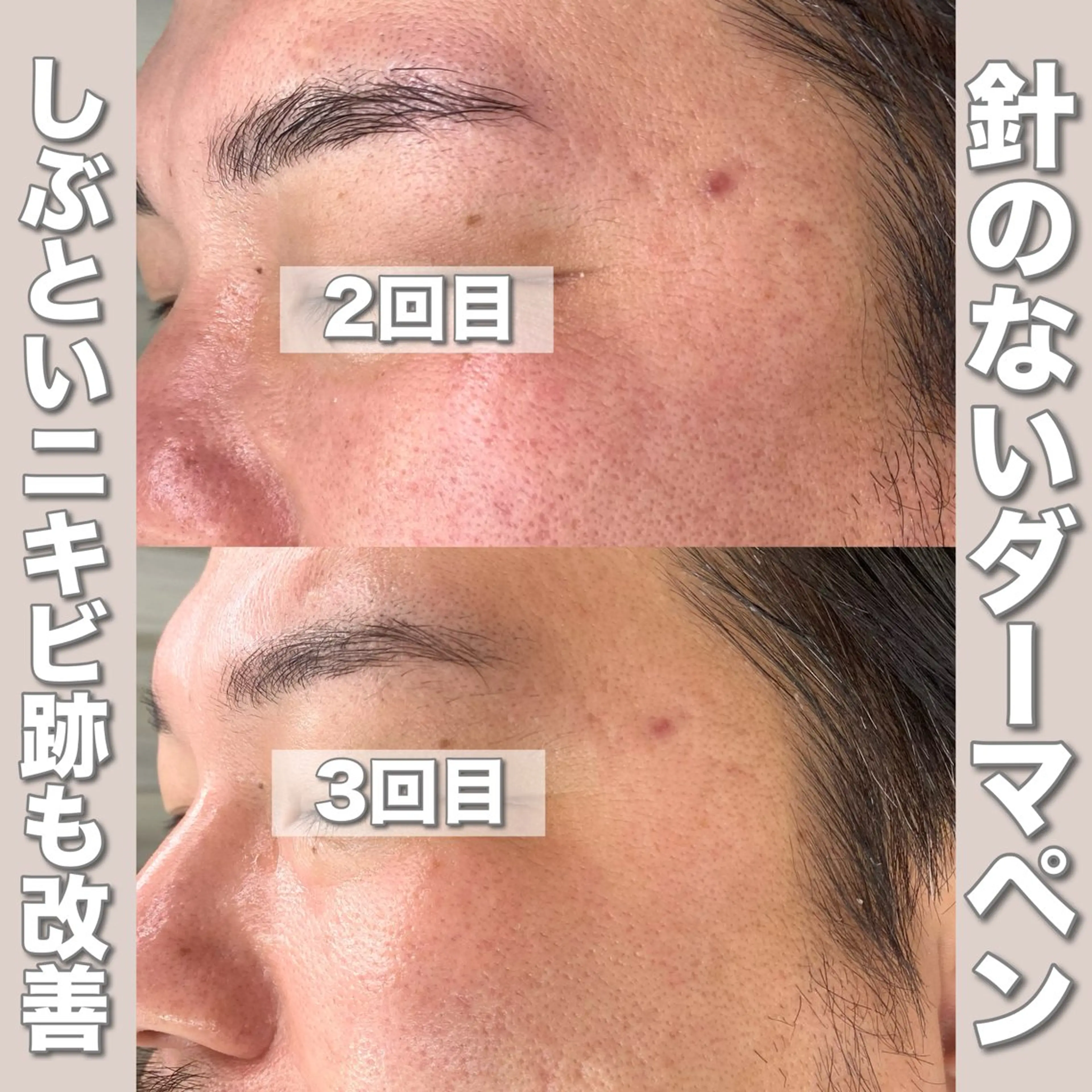 エステ mone~total care salon~所属・mone (モーネ)のマツエク・マツパデザイン