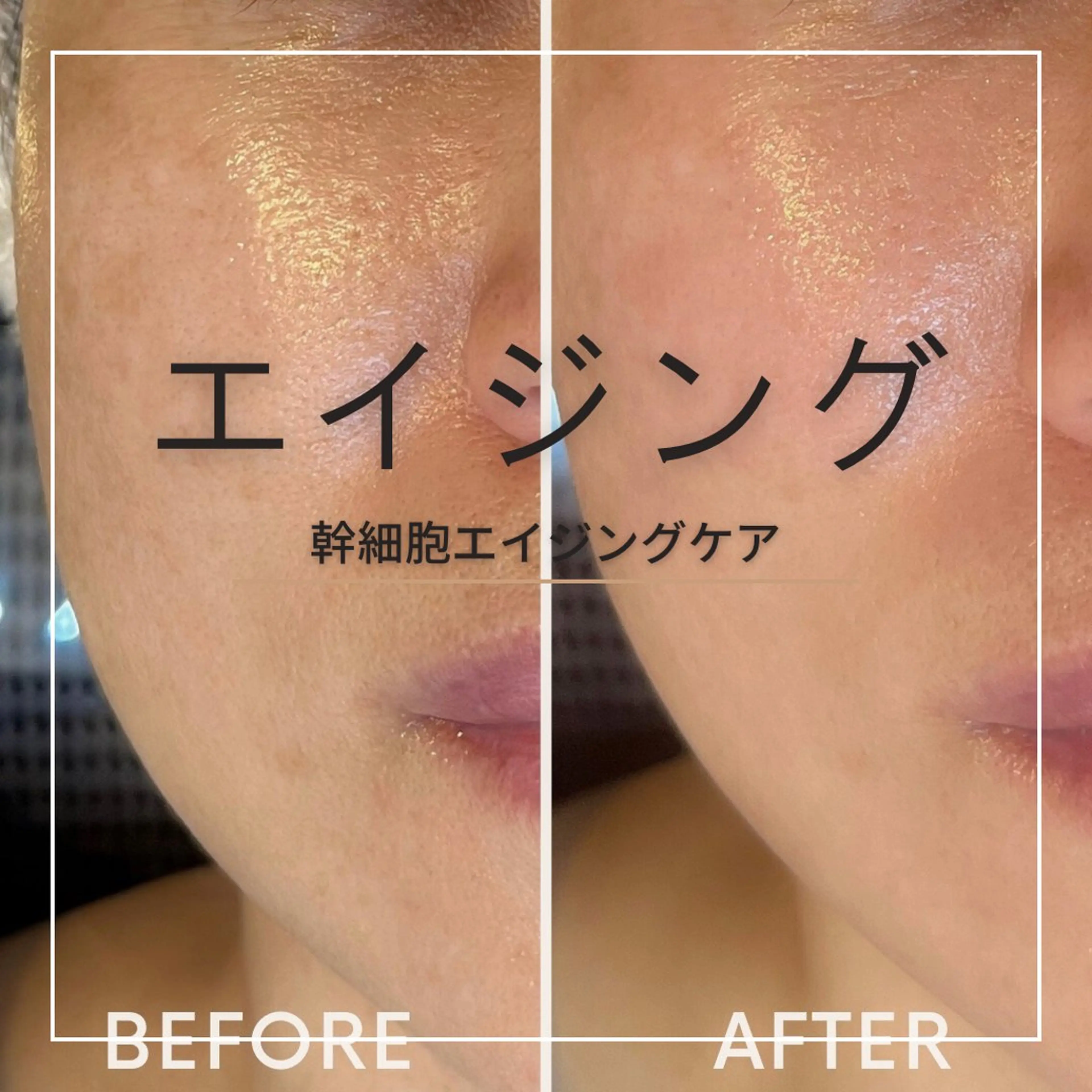 6,000円 幹細胞エイジングケア ハリツヤup！の写真