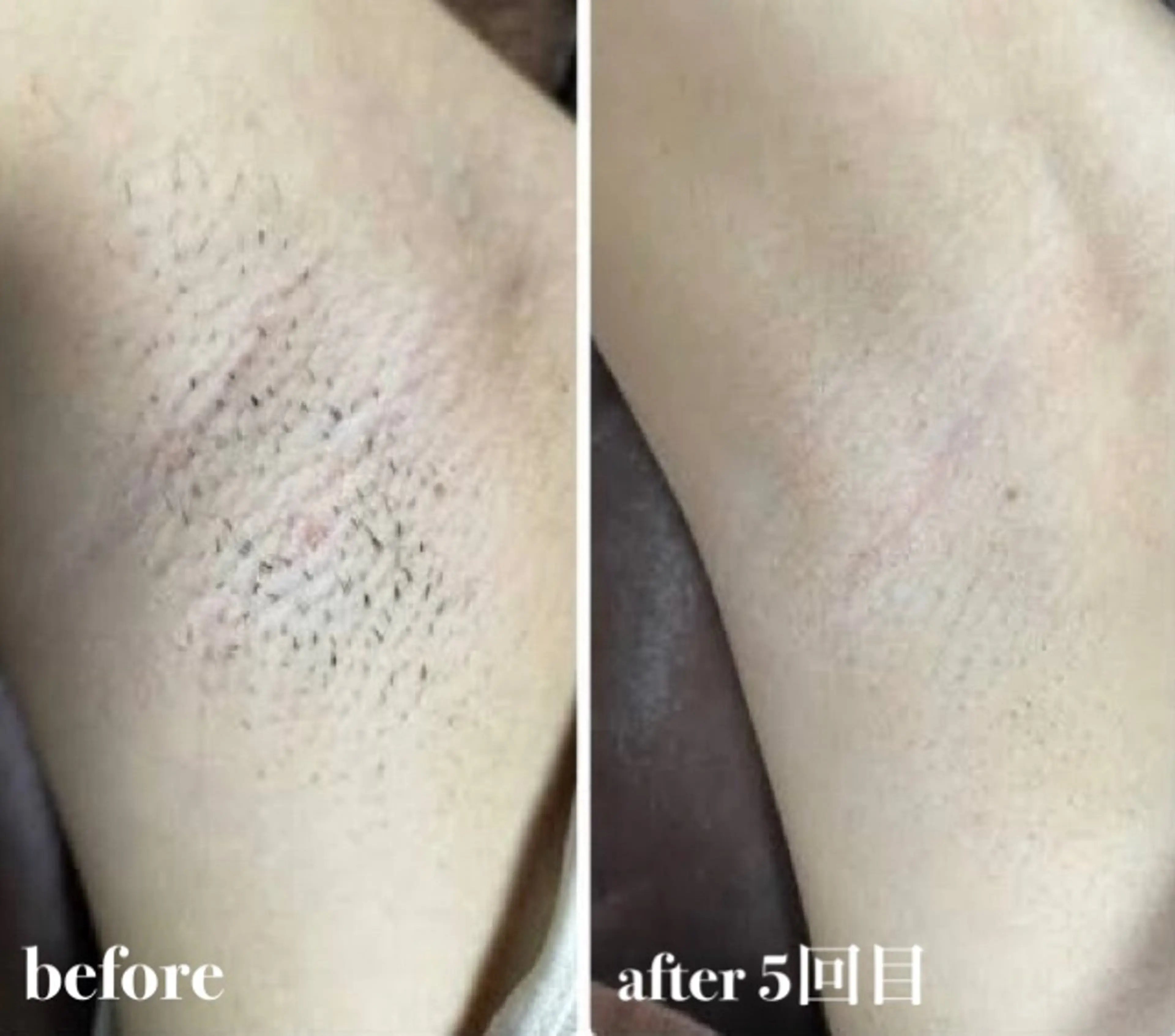 NAZ  (ナーズ)のエステ・リラクイメージ