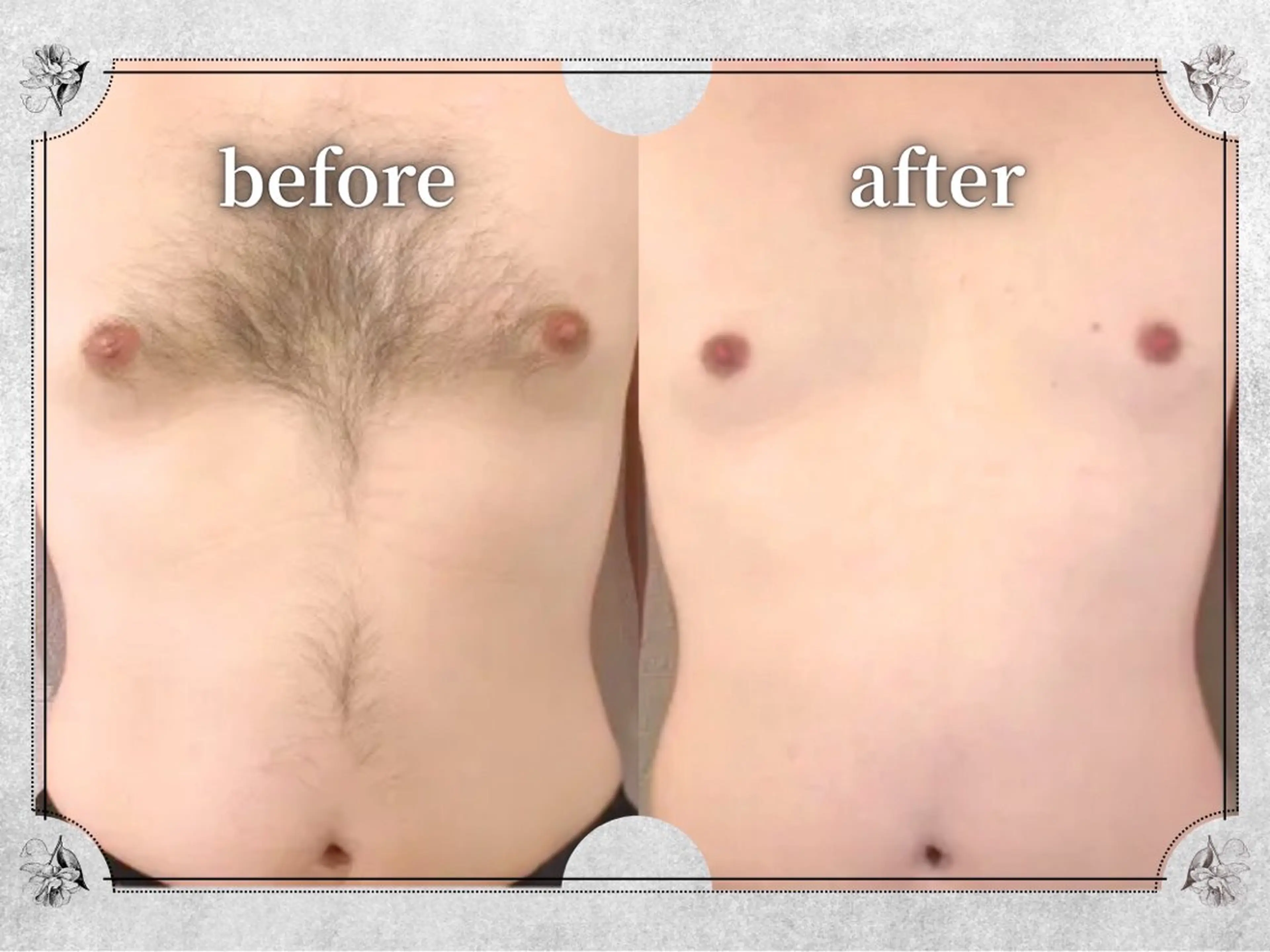 都度払い 脱毛 Lino柏/moeのエステ・リラクイメージ