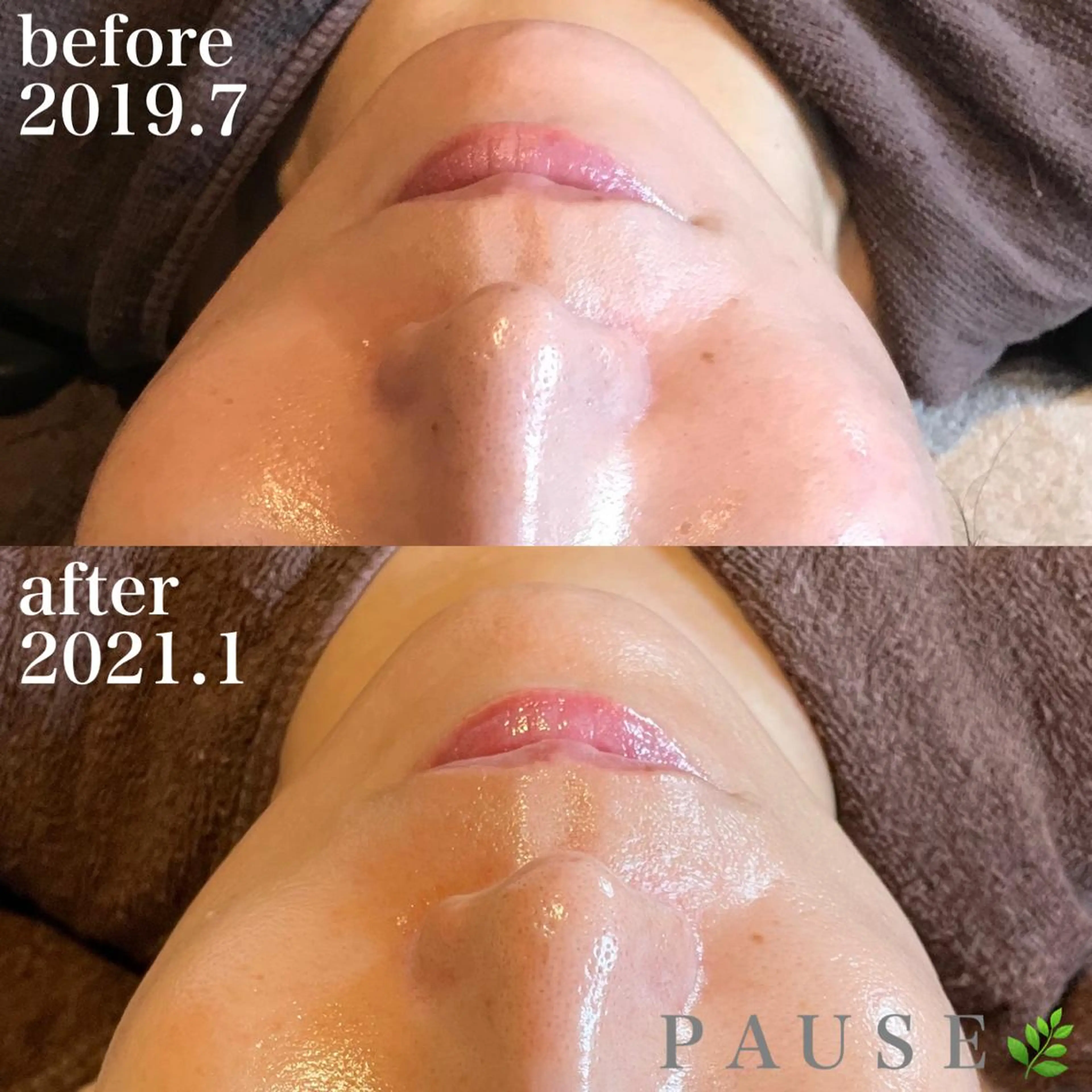 エステ 浜野 恵美のエステ・リラクイメージ