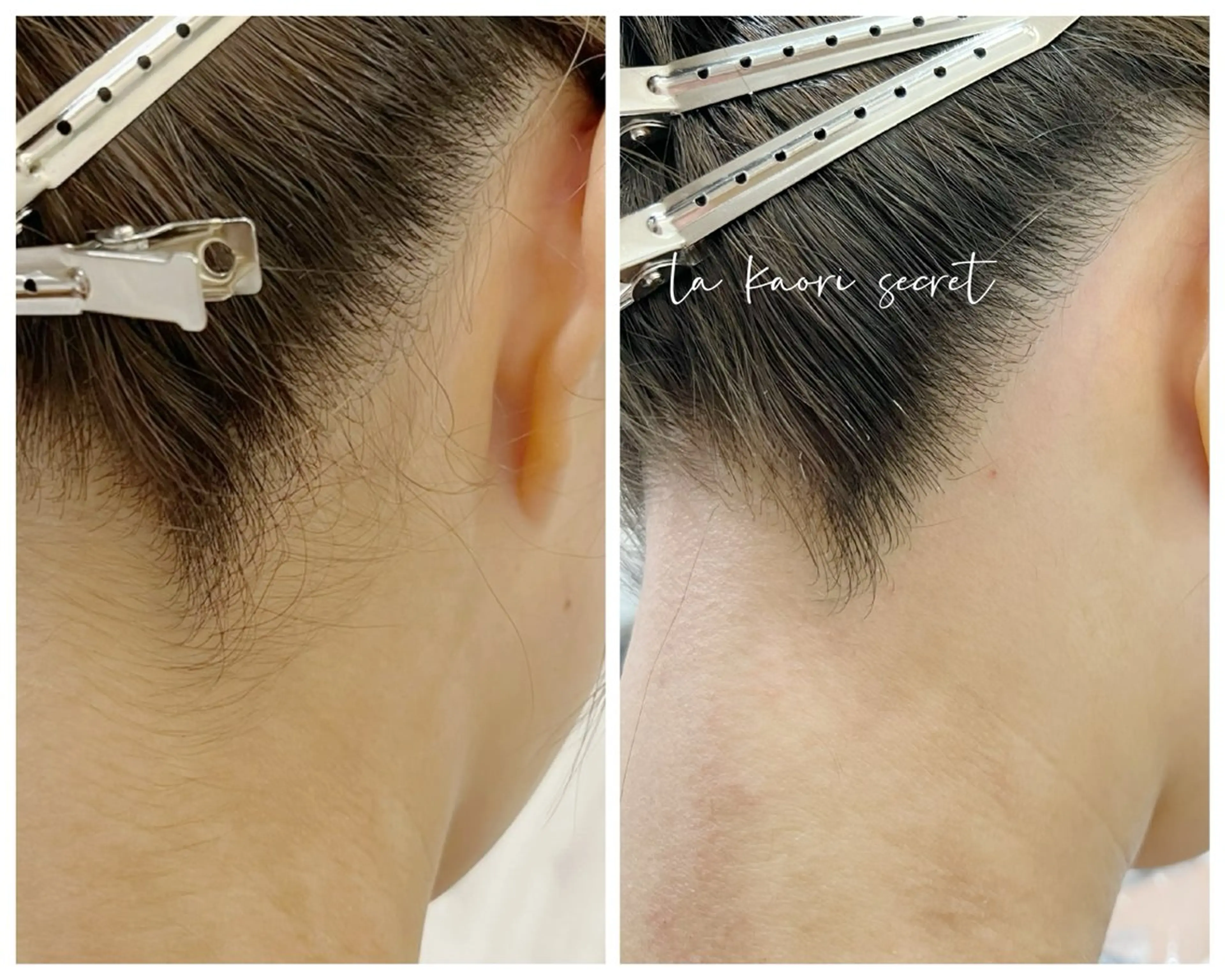 ミディアム 脱毛 la kaori secretの眉毛・アイブロウイメージ