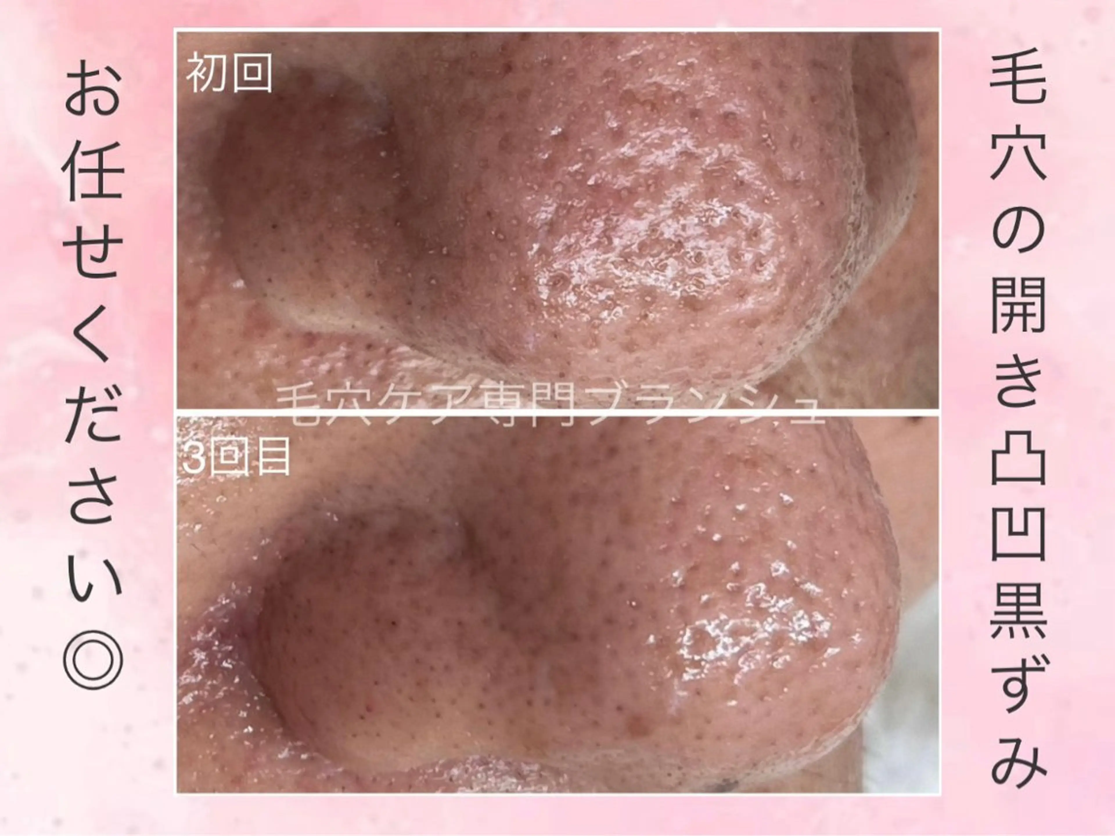 BLANCHE Nailのネイルデザイン