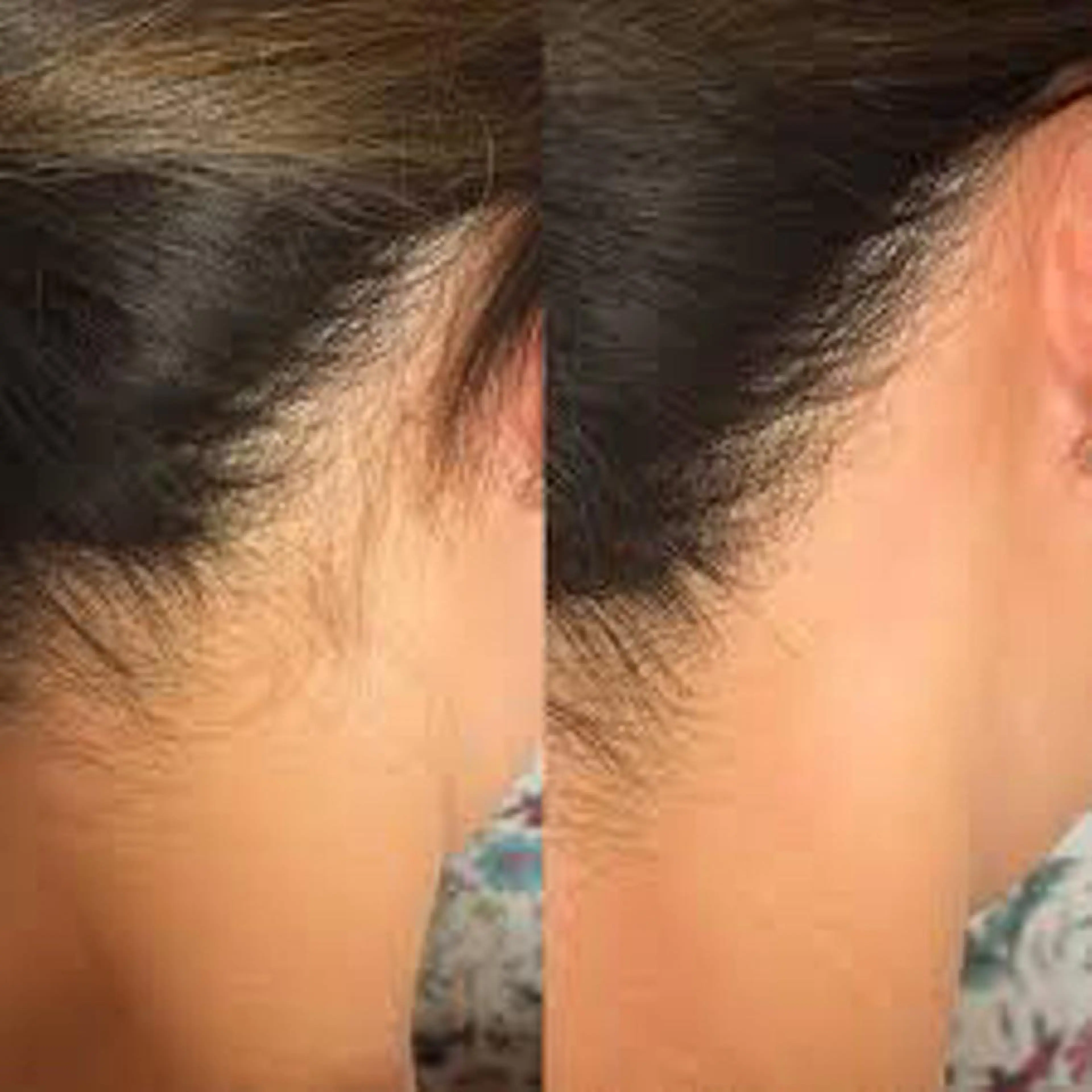 脱毛 オーガニック エステ サロンフィオーレのエステ・リラクイメージ