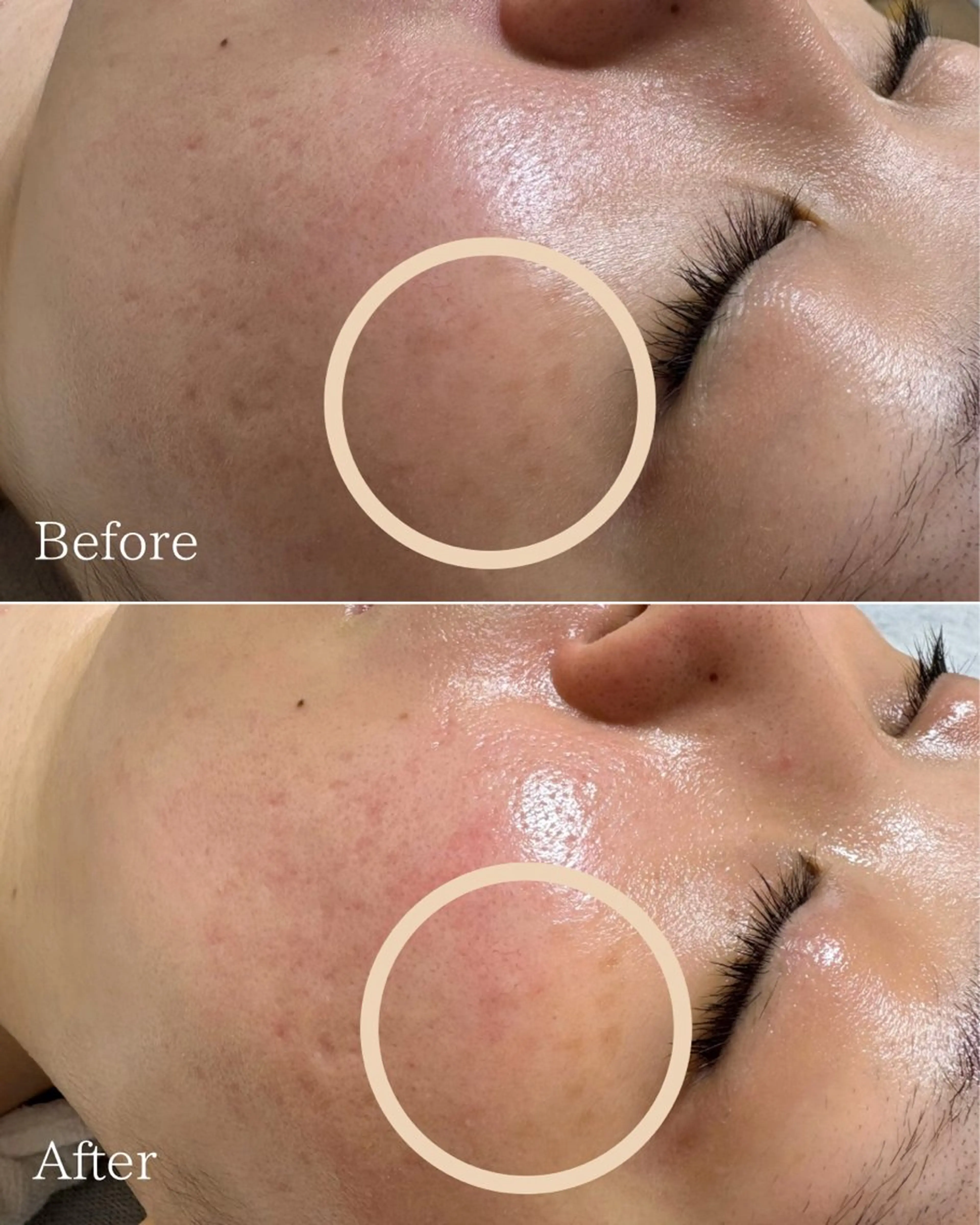 エステと焼き菓子 レモンバームソワンのエステ・リラクイメージ