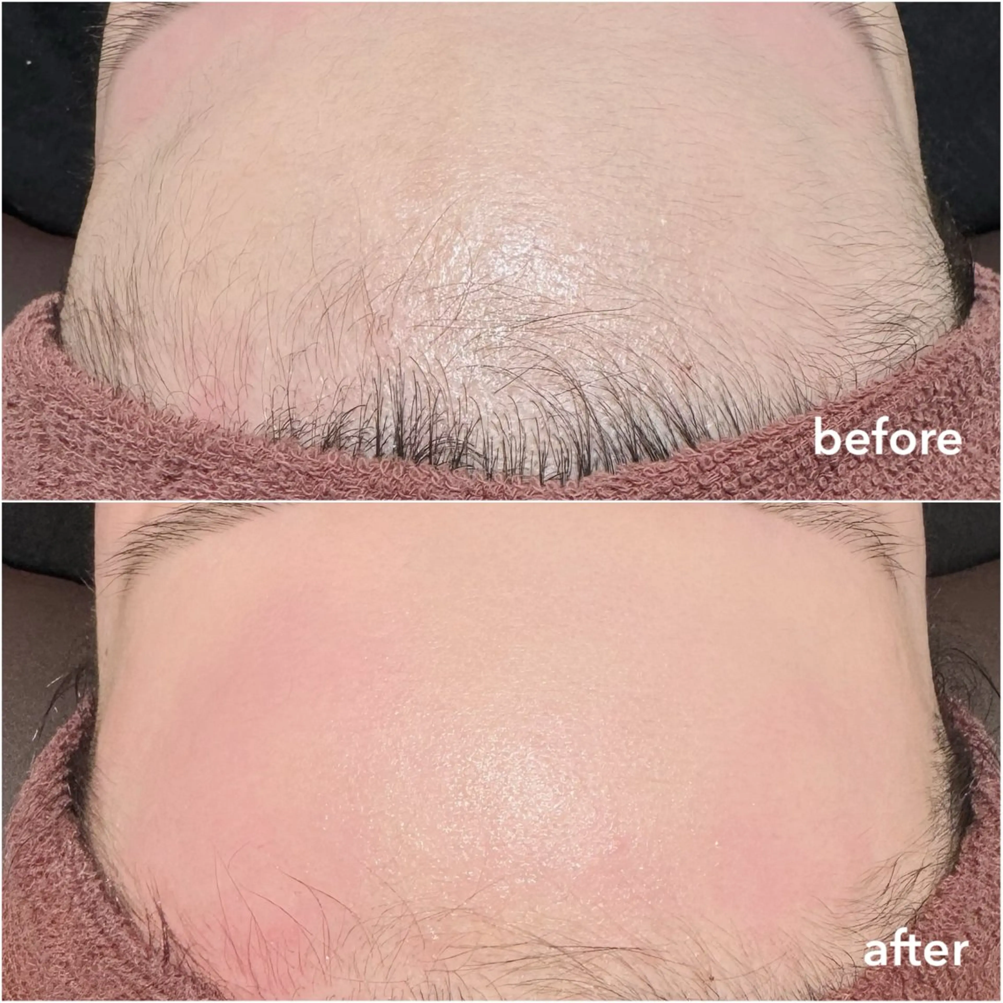 REVE （レーヴ）のマツエク・マツパデザイン