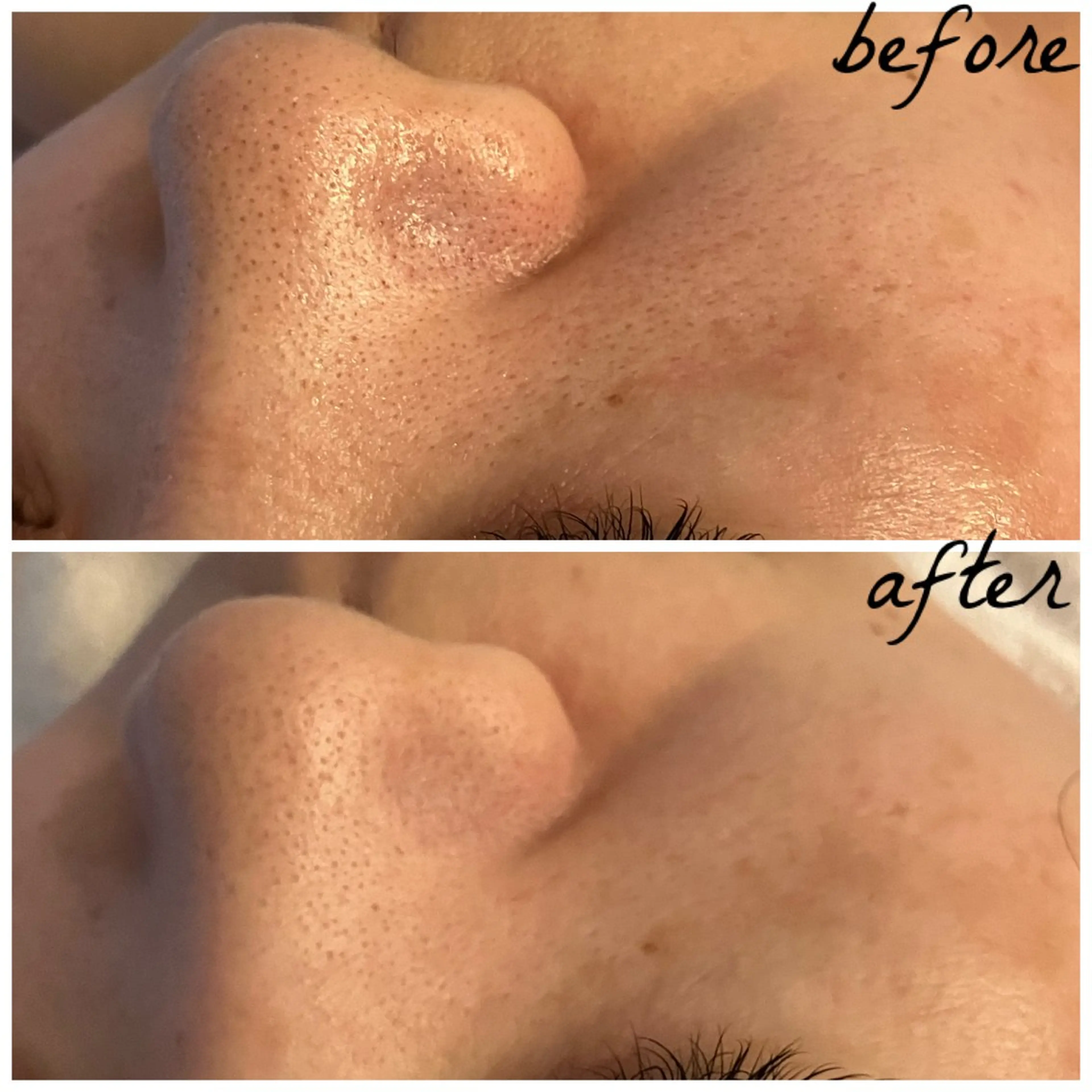 メンズ エステ メナード岐阜茜部 杉浦のエステ・リラクイメージ