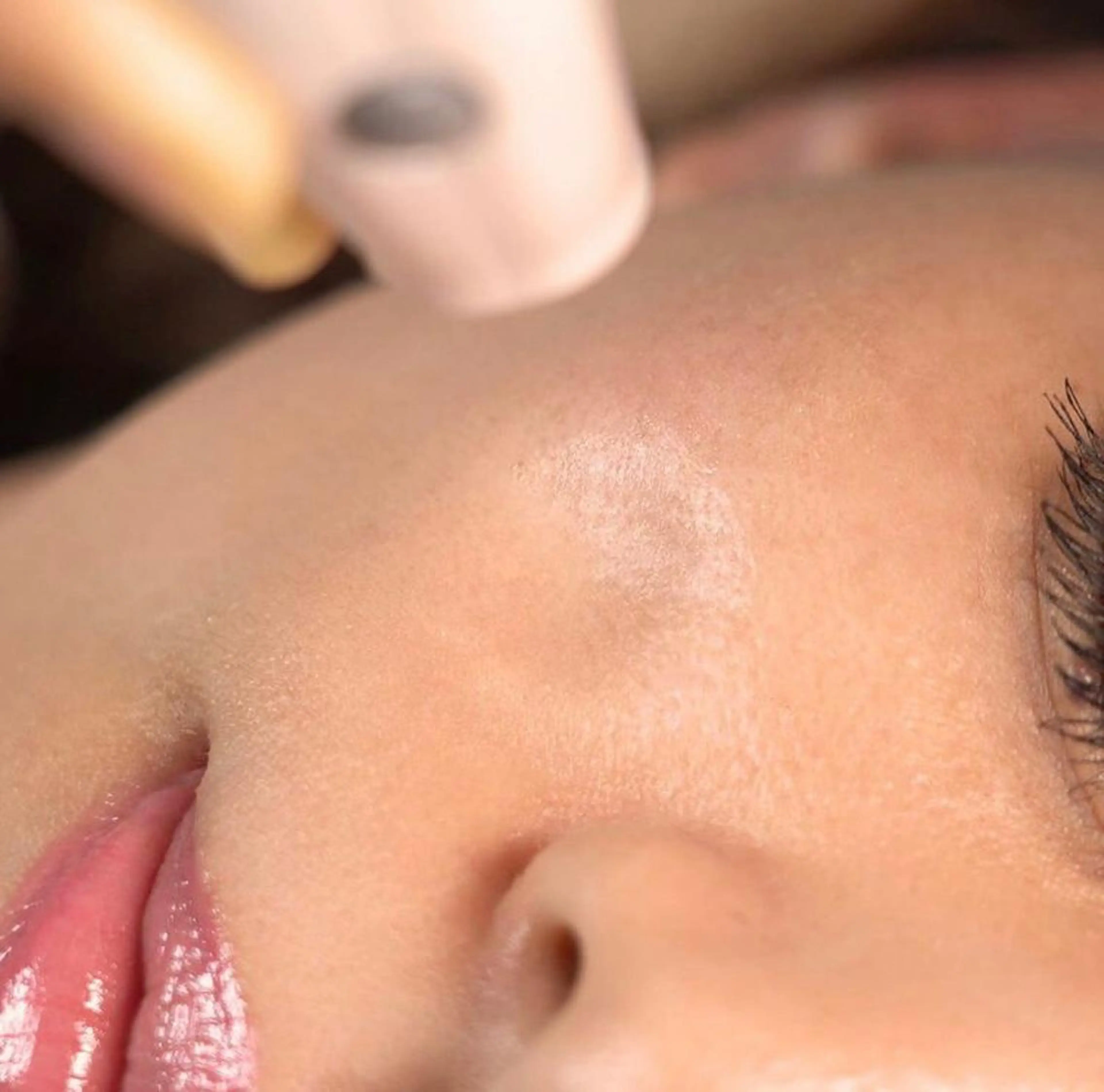 エステ リラク emiluca西目/ 毛穴洗浄/細胞美容のエステ・リラクイメージ