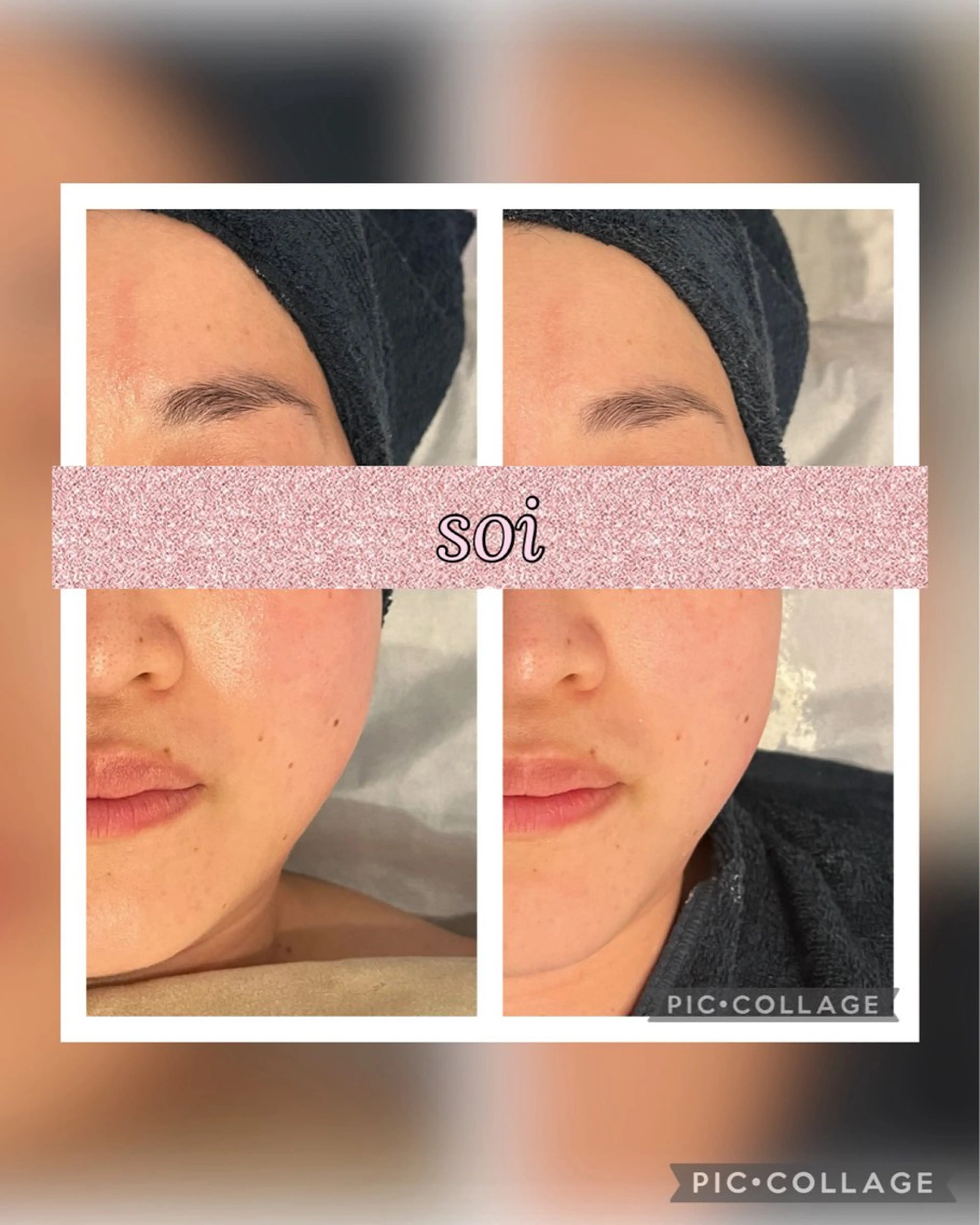 soi所属・soi 平賀愛のエステ・リラクイメージ