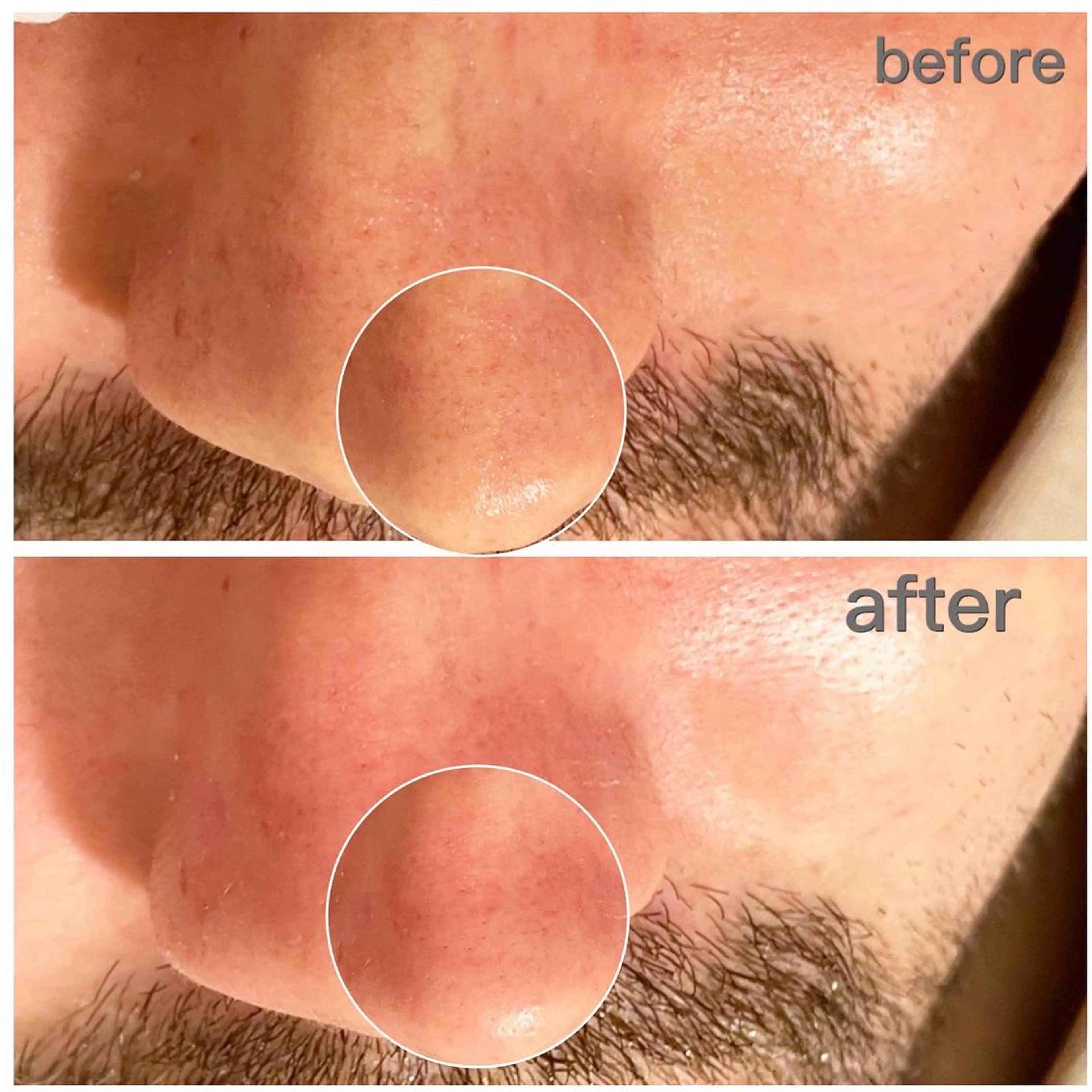 メンズ Mignon +所属・Mignon + Natsukiのマツエク・マツパデザイン