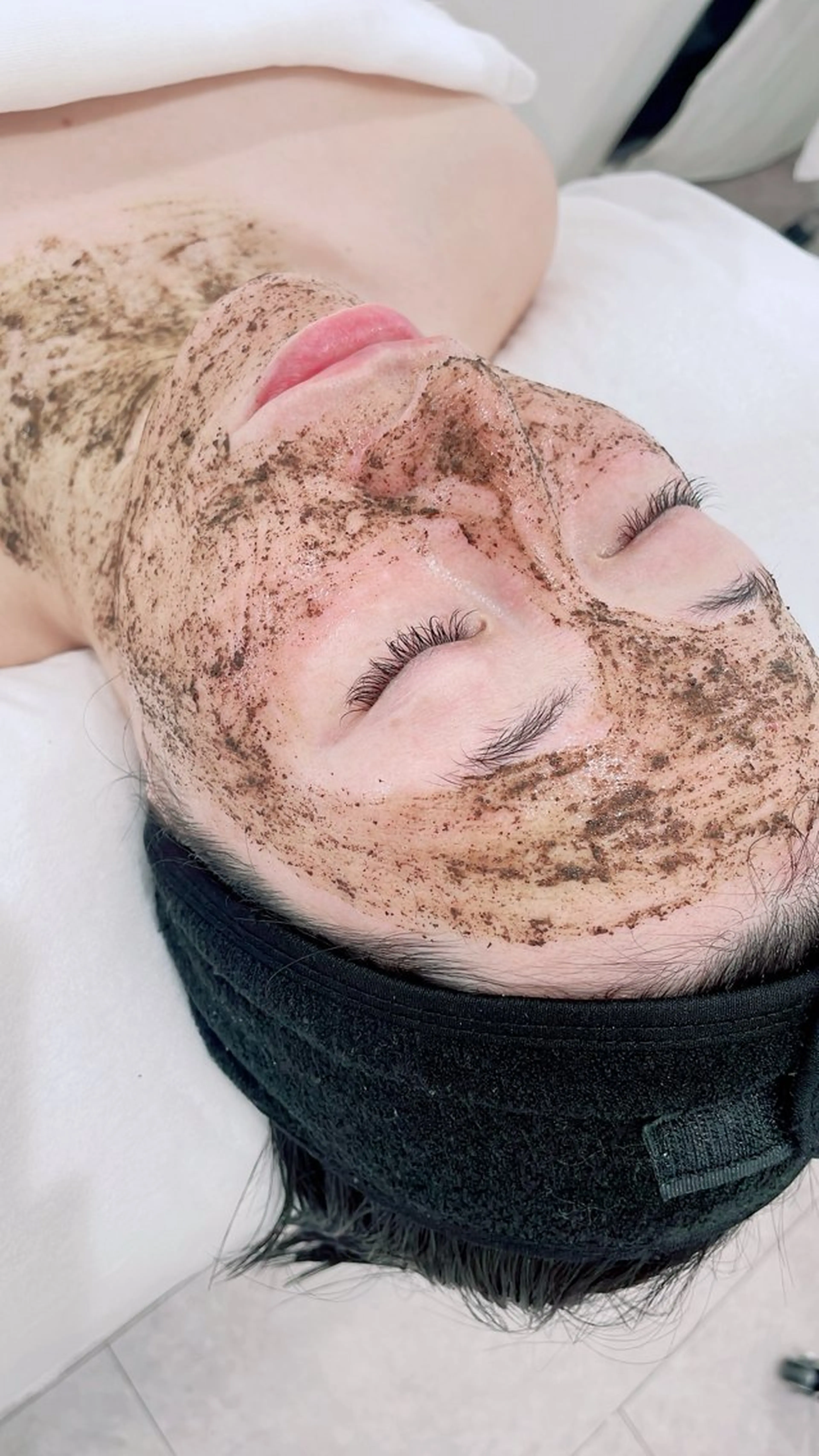 クリスティーナのハーブリプロ（剥離あり）の写真