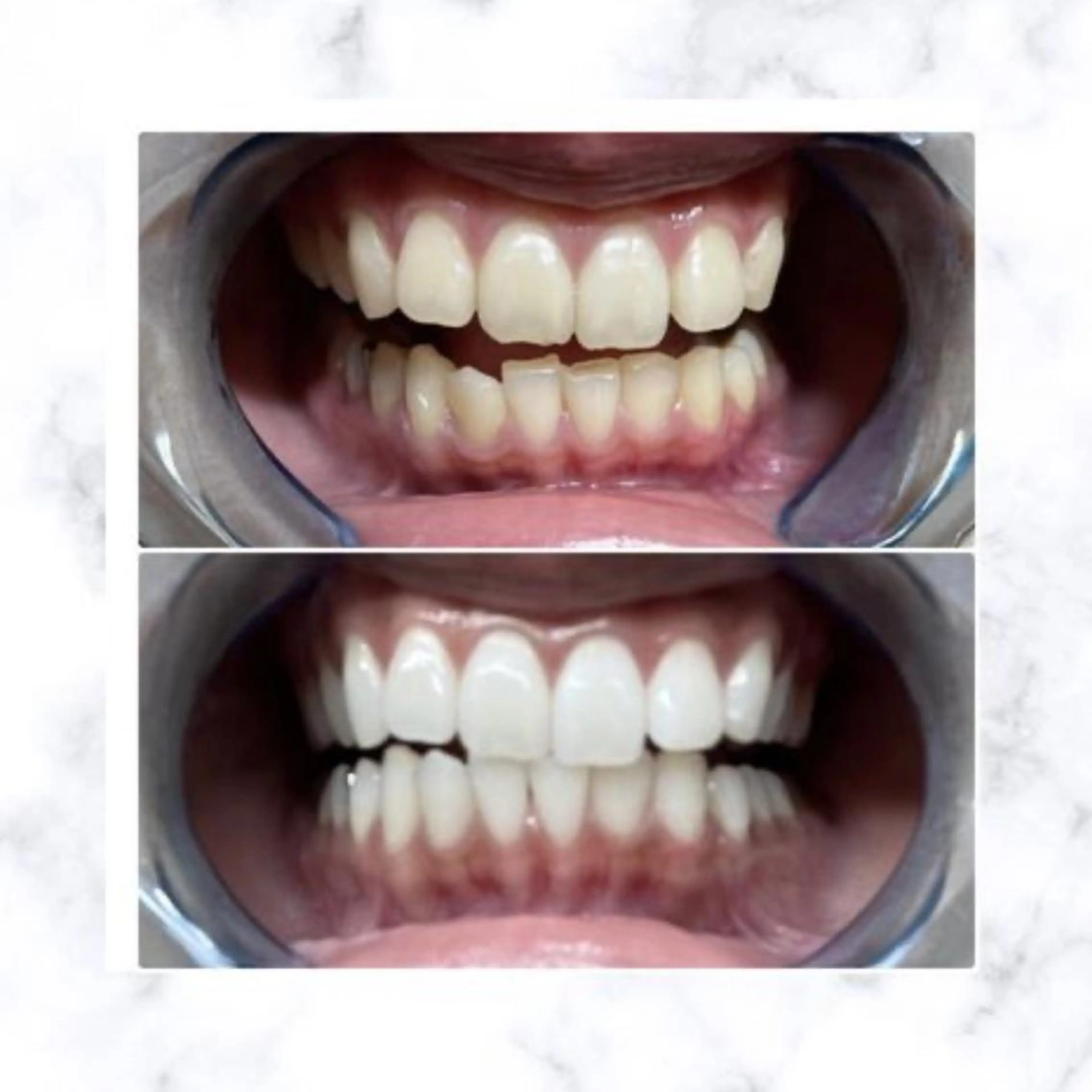 ホワイトニング専門店 LCS 銀座店 峰岡のその他イメージ