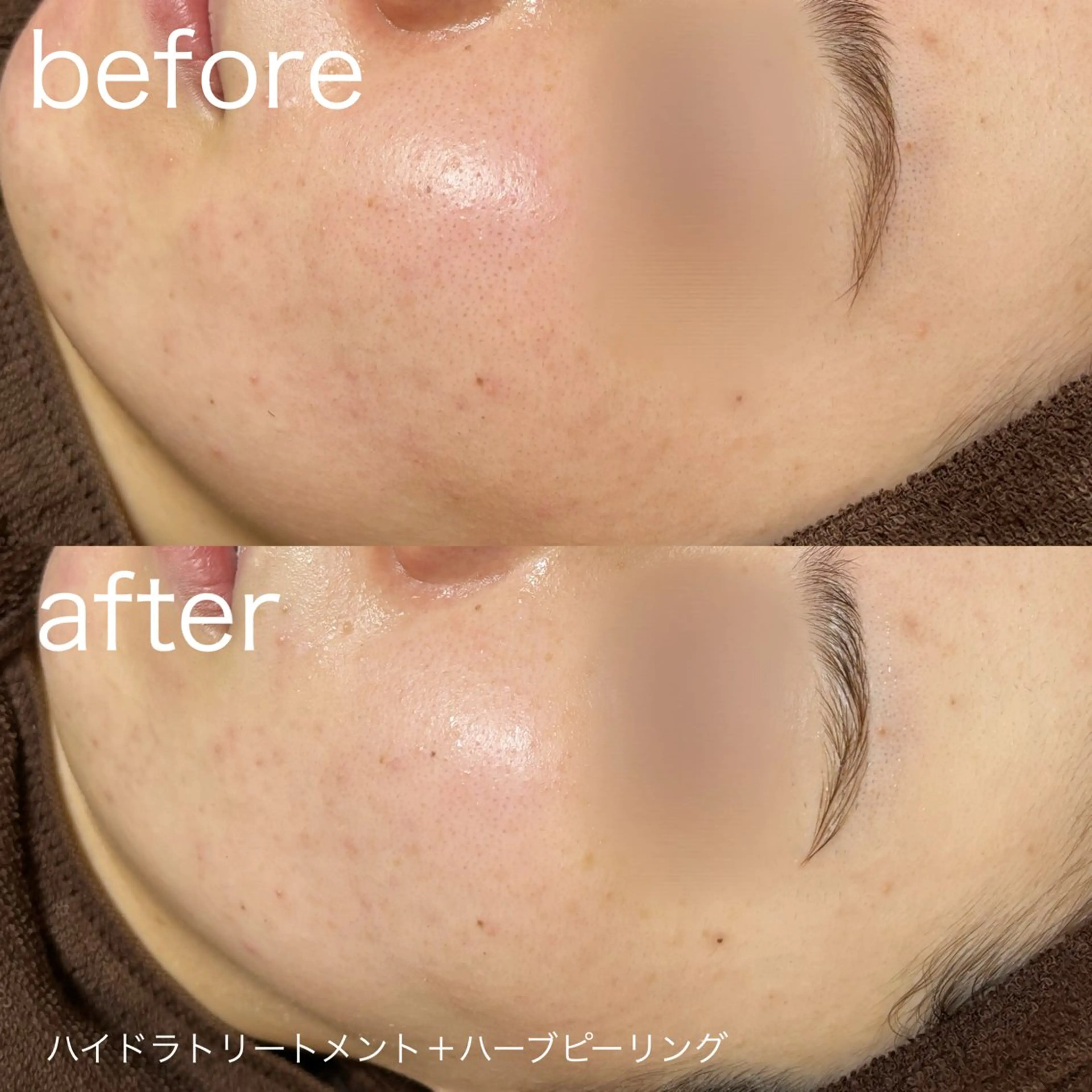 その他 lulularico Yuのエステ・リラクイメージ