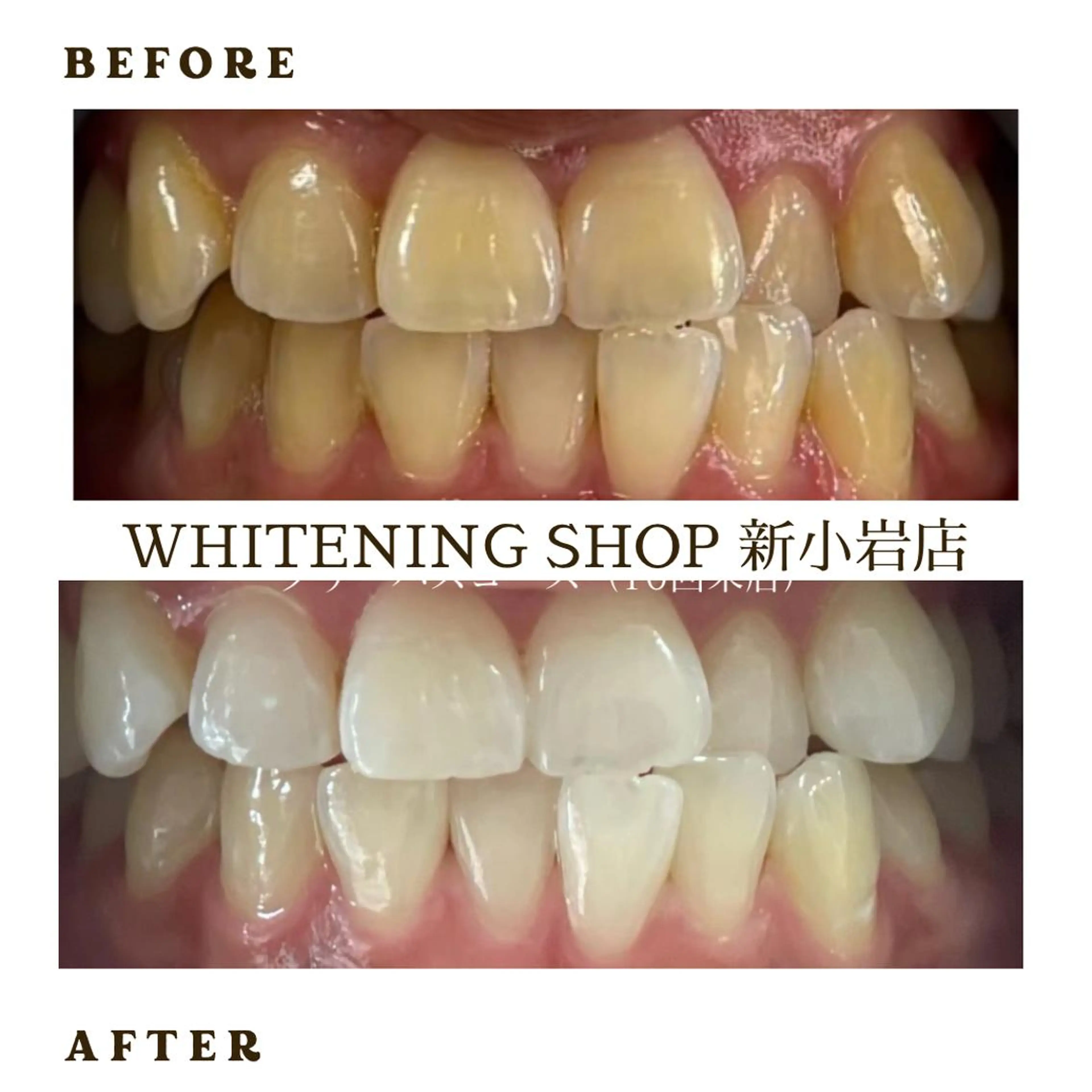 メンズ その他 ホワイトニング ショップ新小岩店のその他イメージ