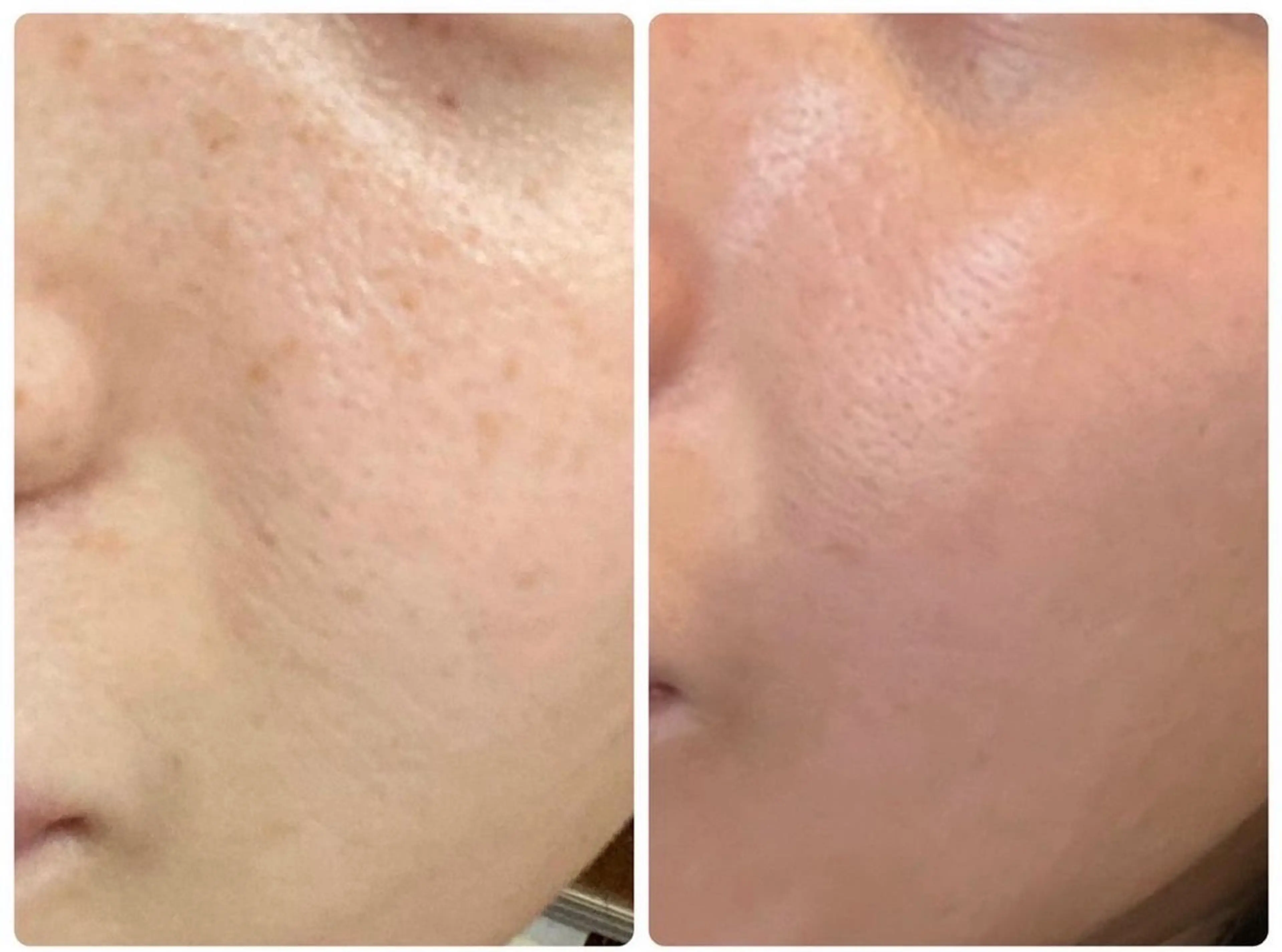 エステ Gemini 　MIKIのエステ・リラクイメージ