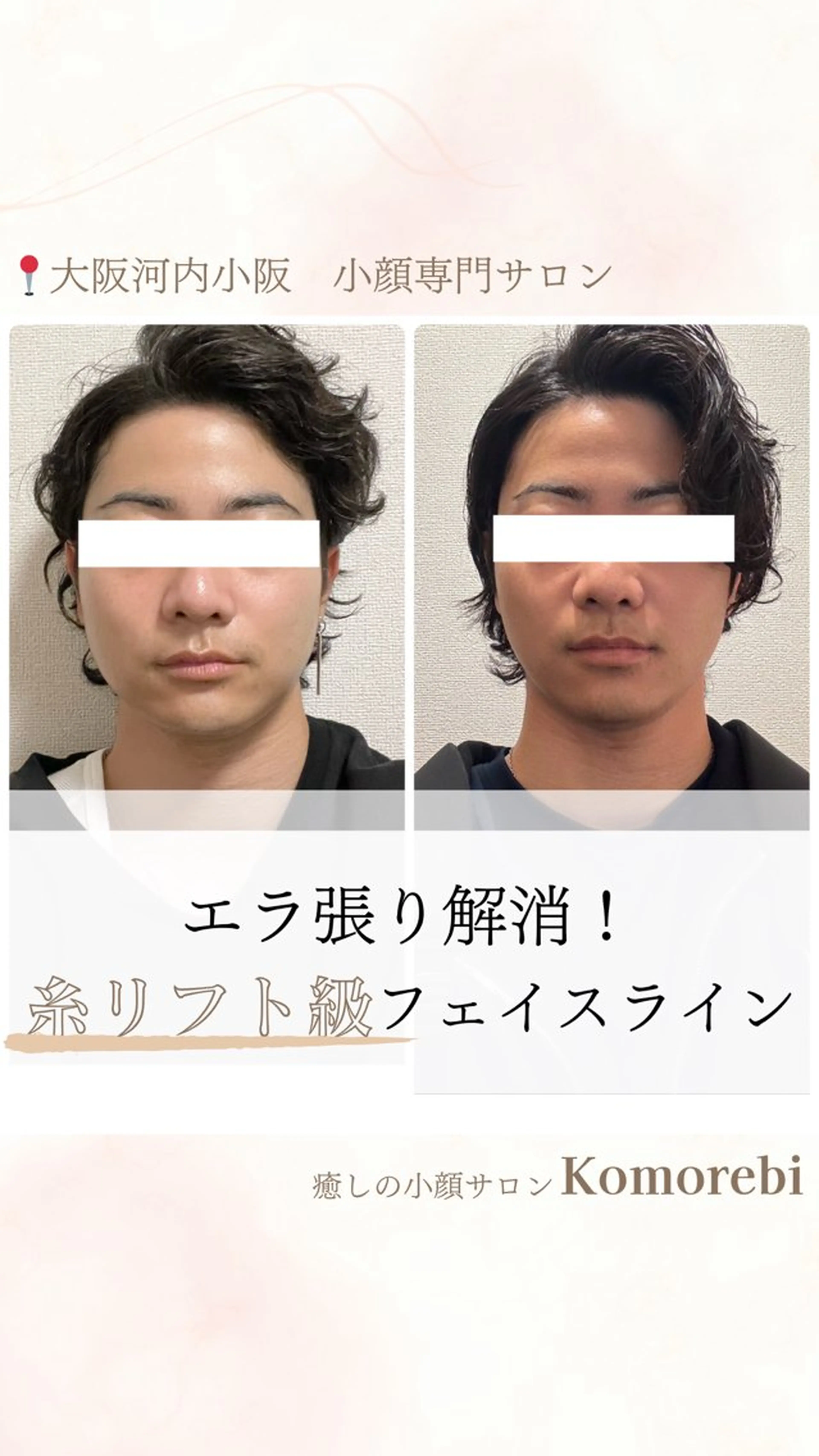 営業電話❌小顔サロン Komorebiのエステ・リラクイメージ