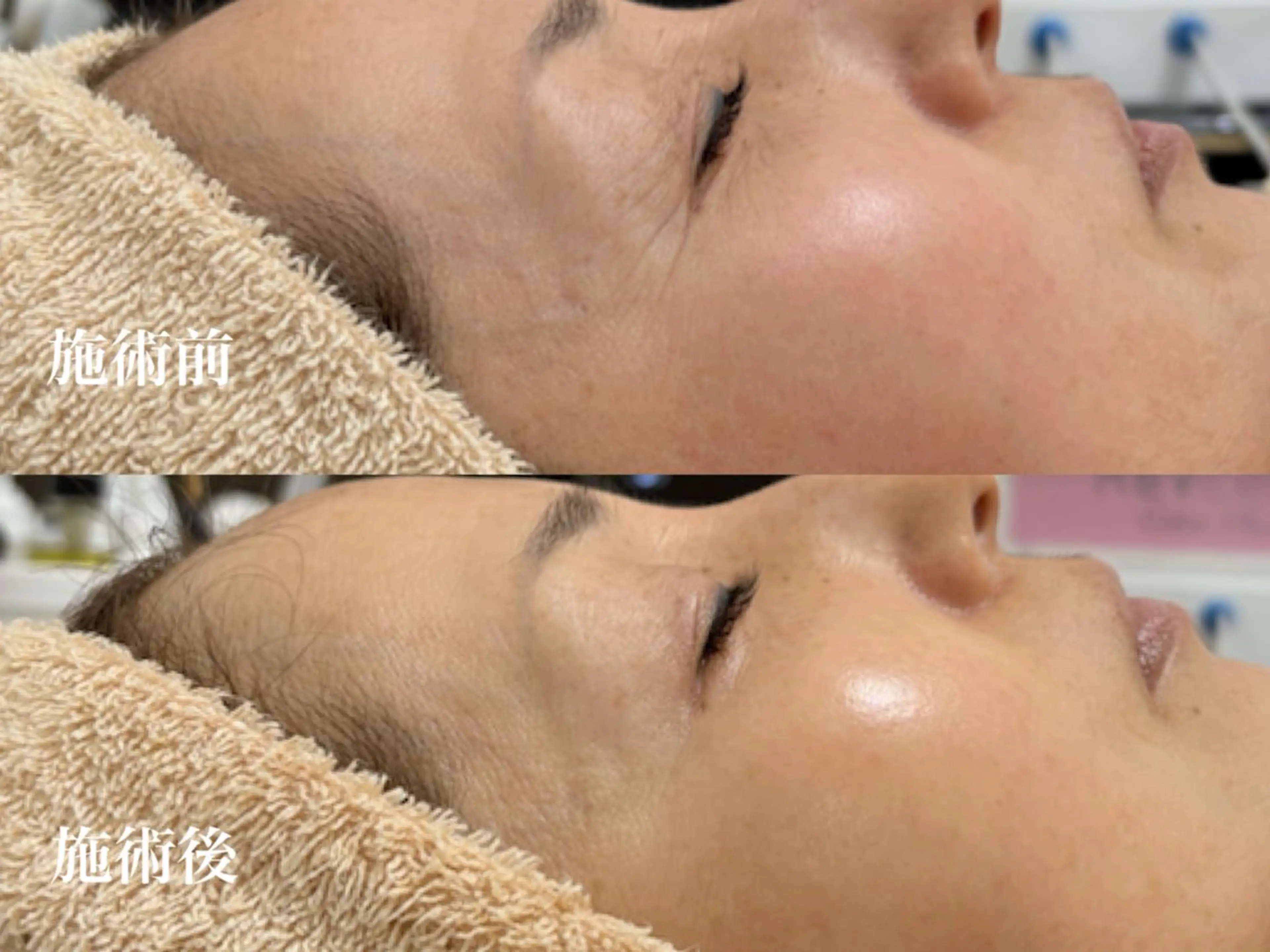 フェイシャルサロンKey of Face所属・村上 貴子のエステ・リラクイメージ