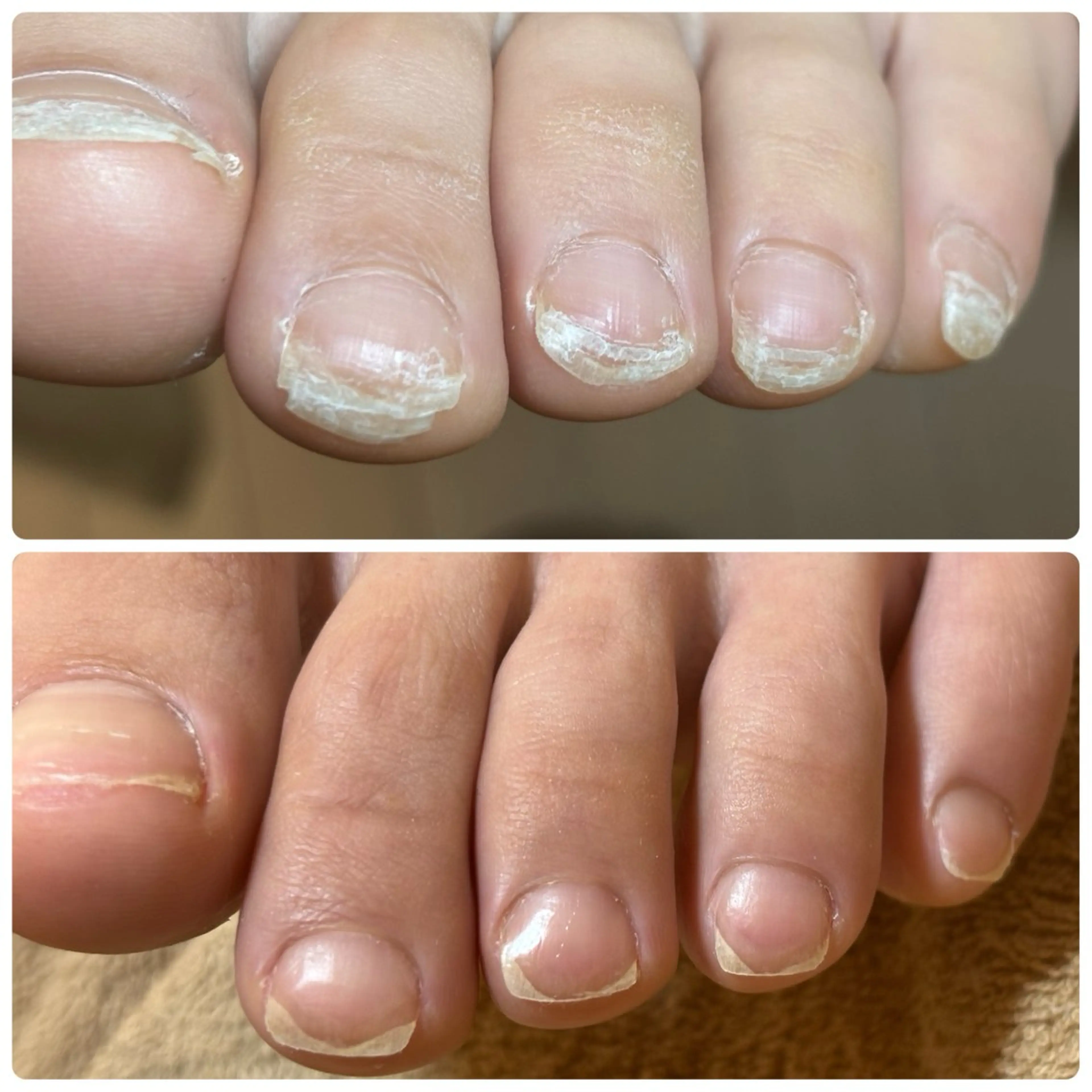 ネイル フットネイル その他(ネイル) メンズトータルビューティーwellnessMARCA所属・【メンズ美容】 三浦かえでのエステ・リラクイメージ