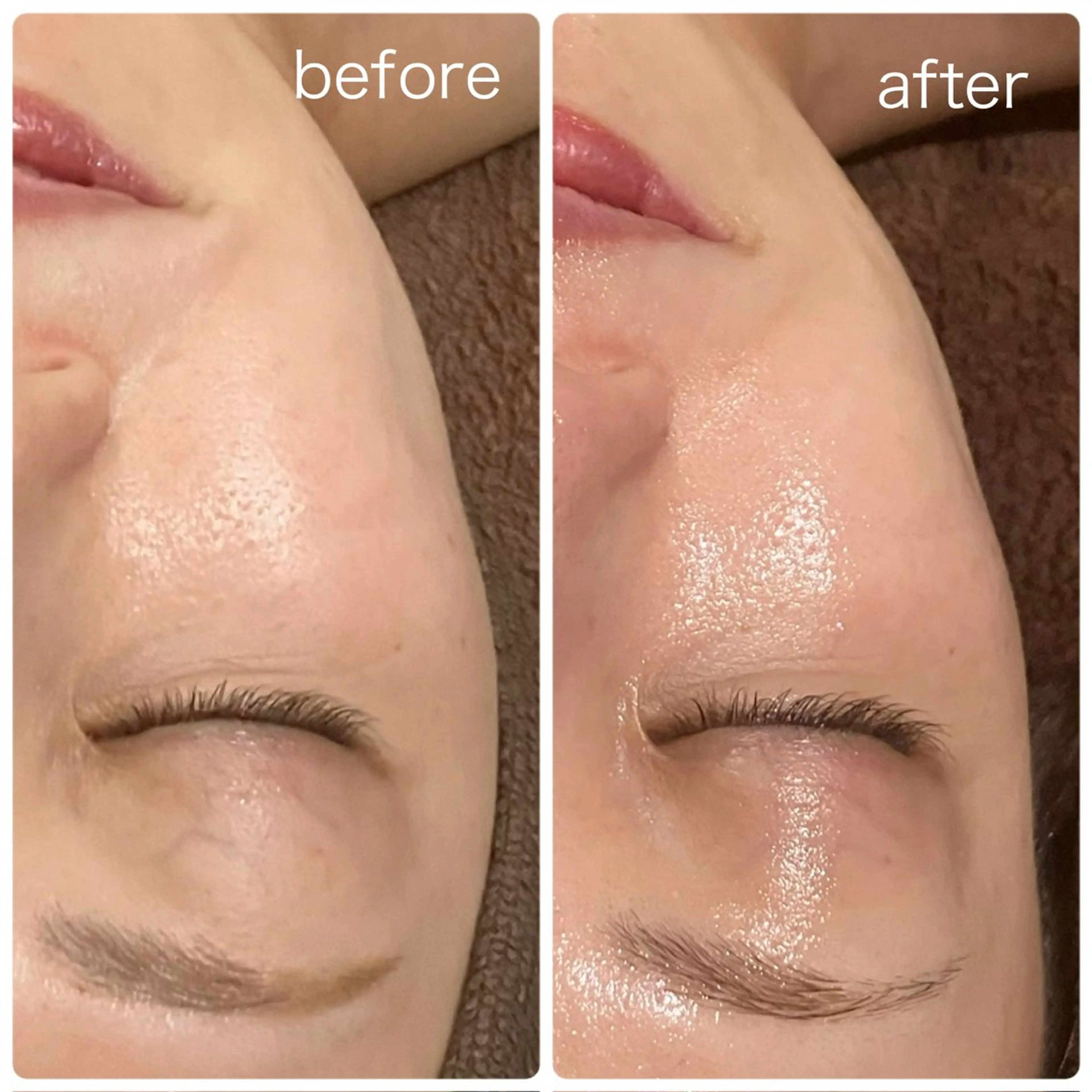 すっぴんツヤ肌✨LDM🫧＆ラミネーションピール　120minの写真