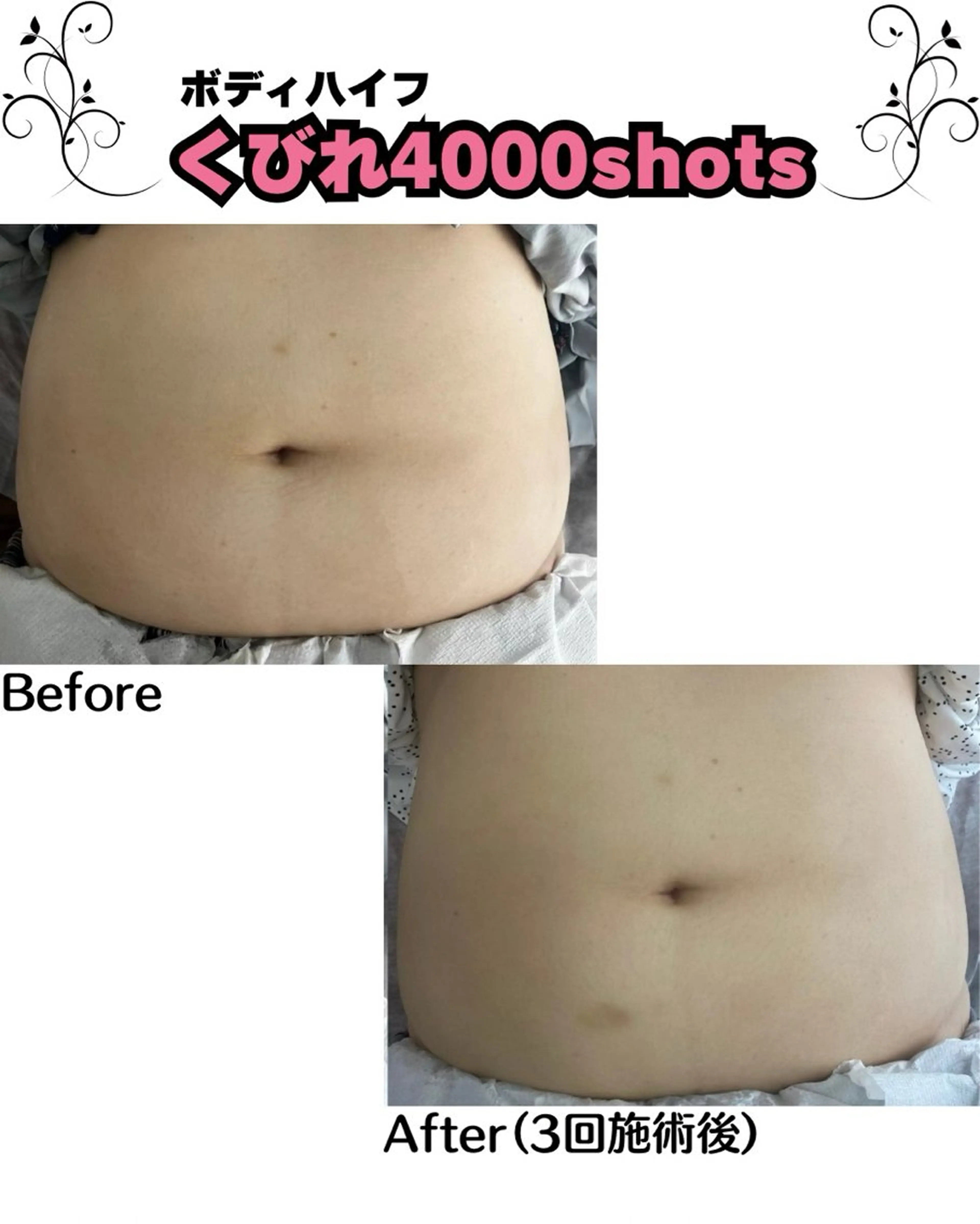 Clear Canvasのエステ・リラクイメージ