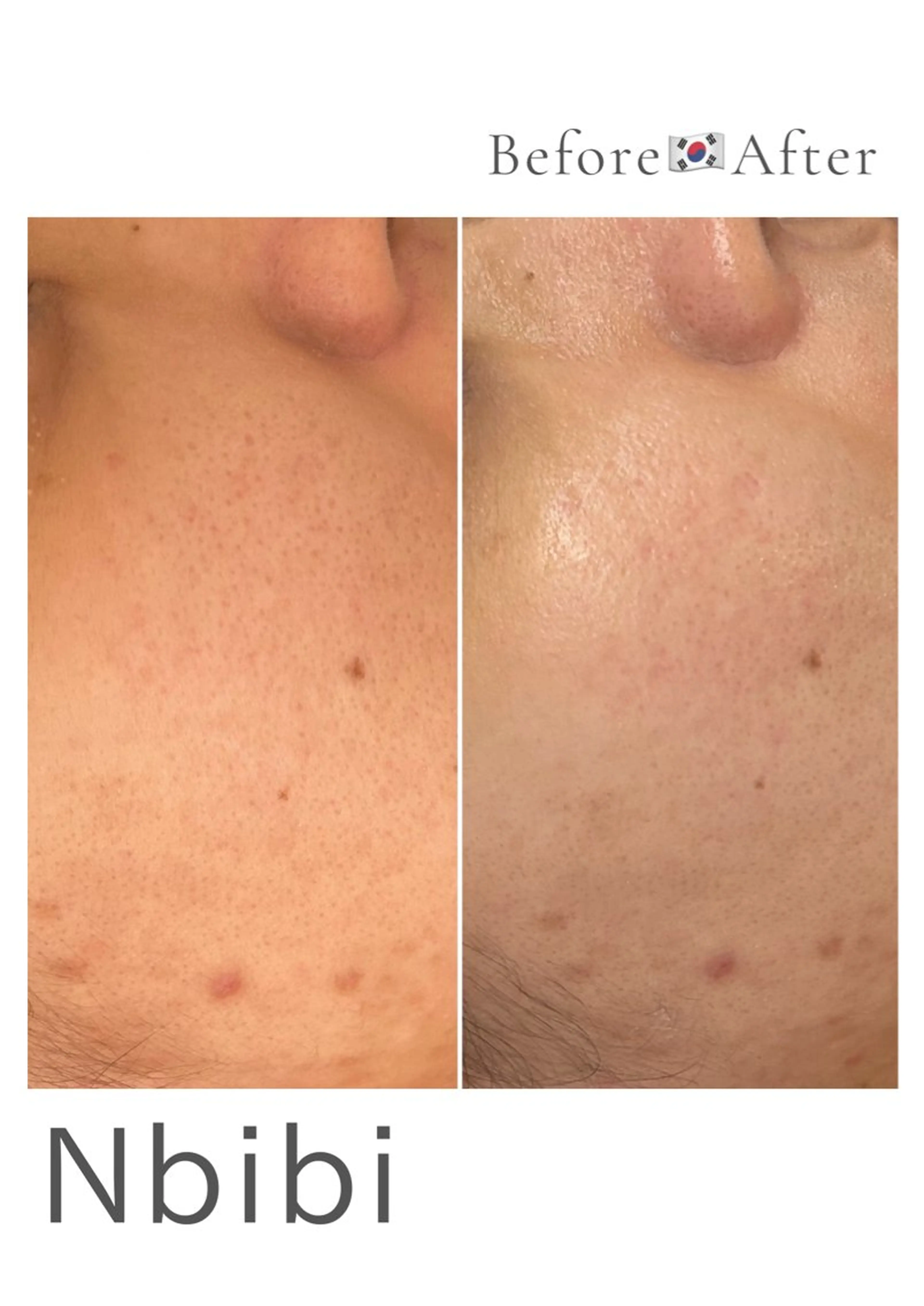 韓国🇰🇷価格 サロン_Nbibiのエステ・リラクイメージ