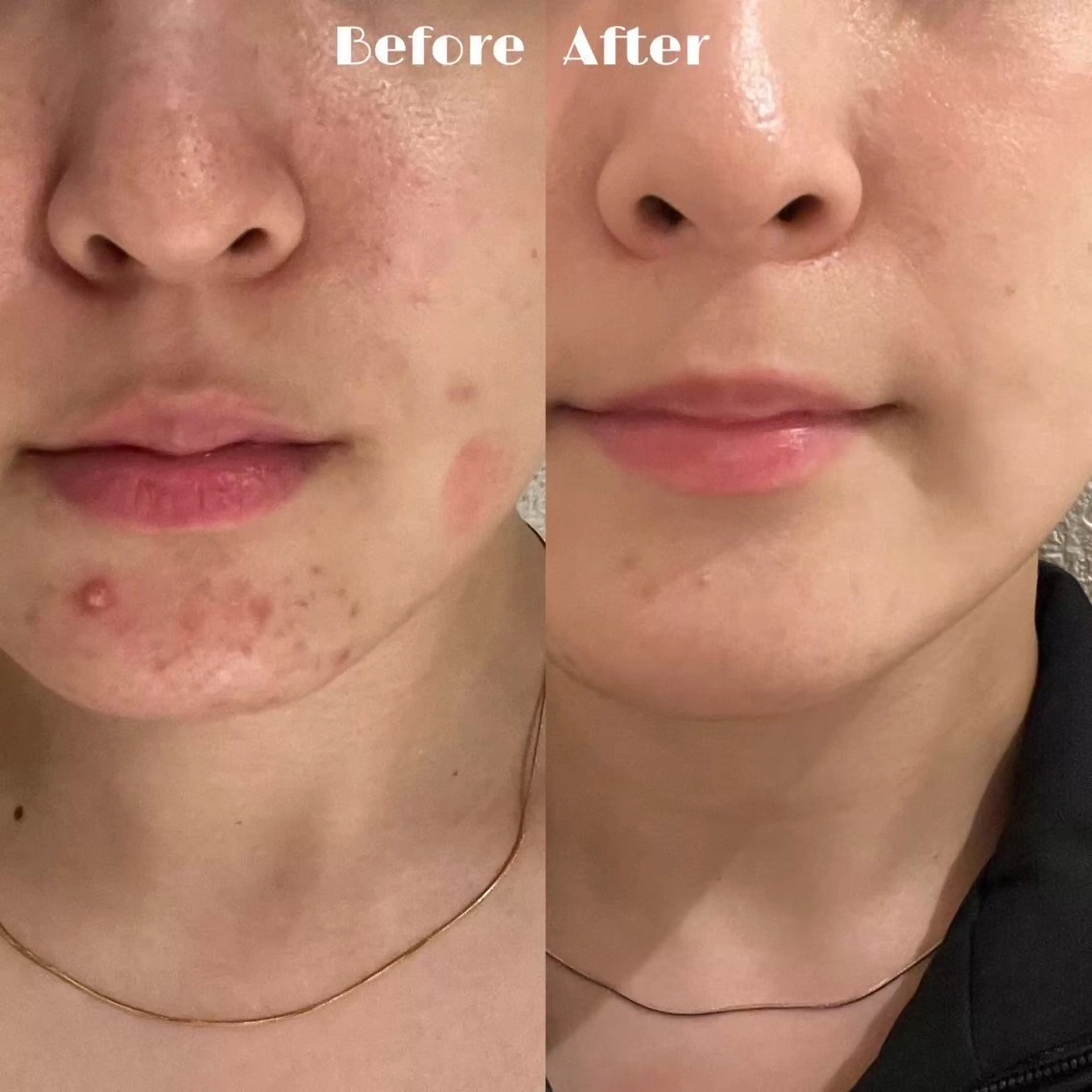 美容革命ラボ福岡春吉店所属・美容革命ラボ 福岡のエステ・リラクイメージ