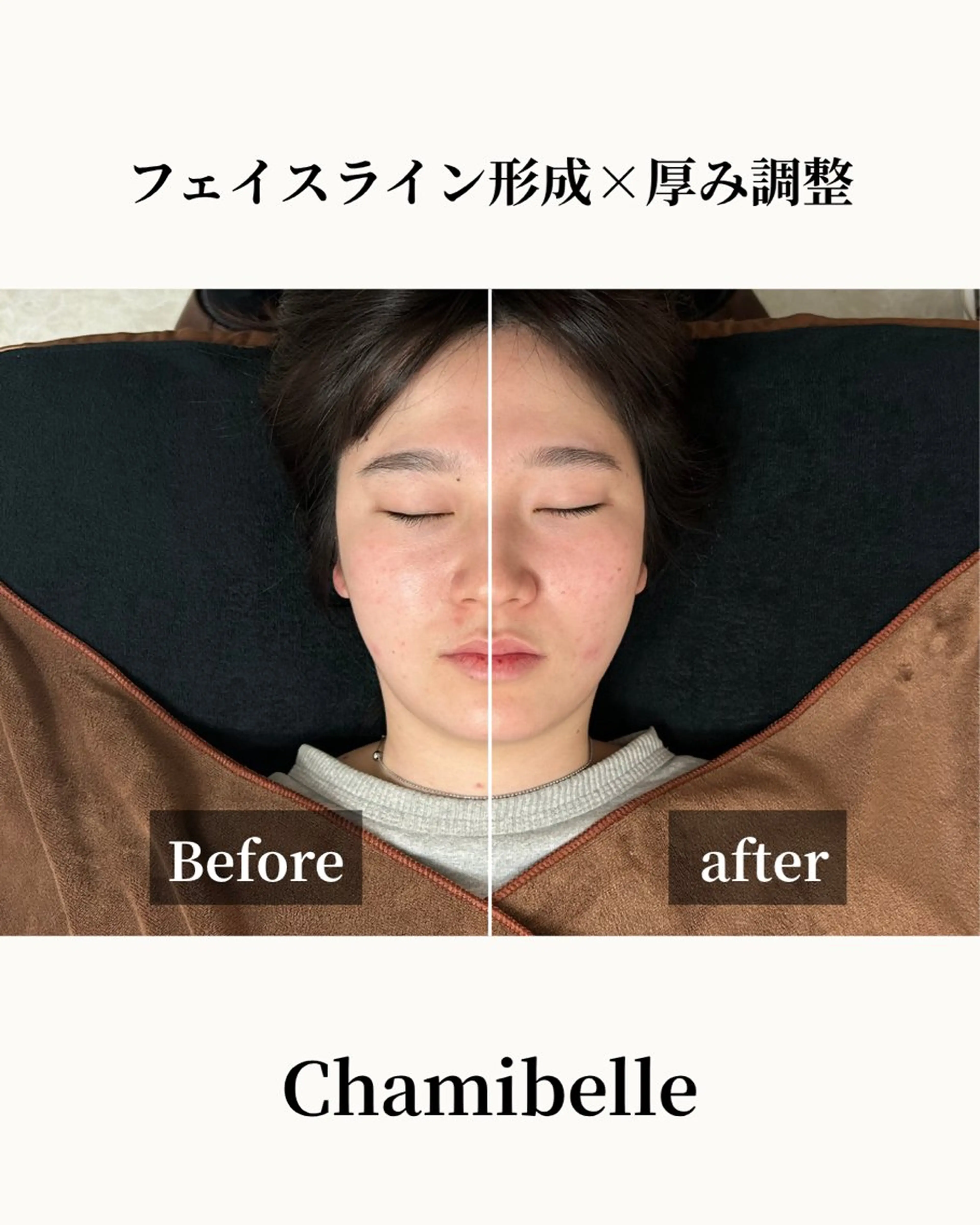 美容鍼灸サロン Chamibelleのエステ・リラクイメージ