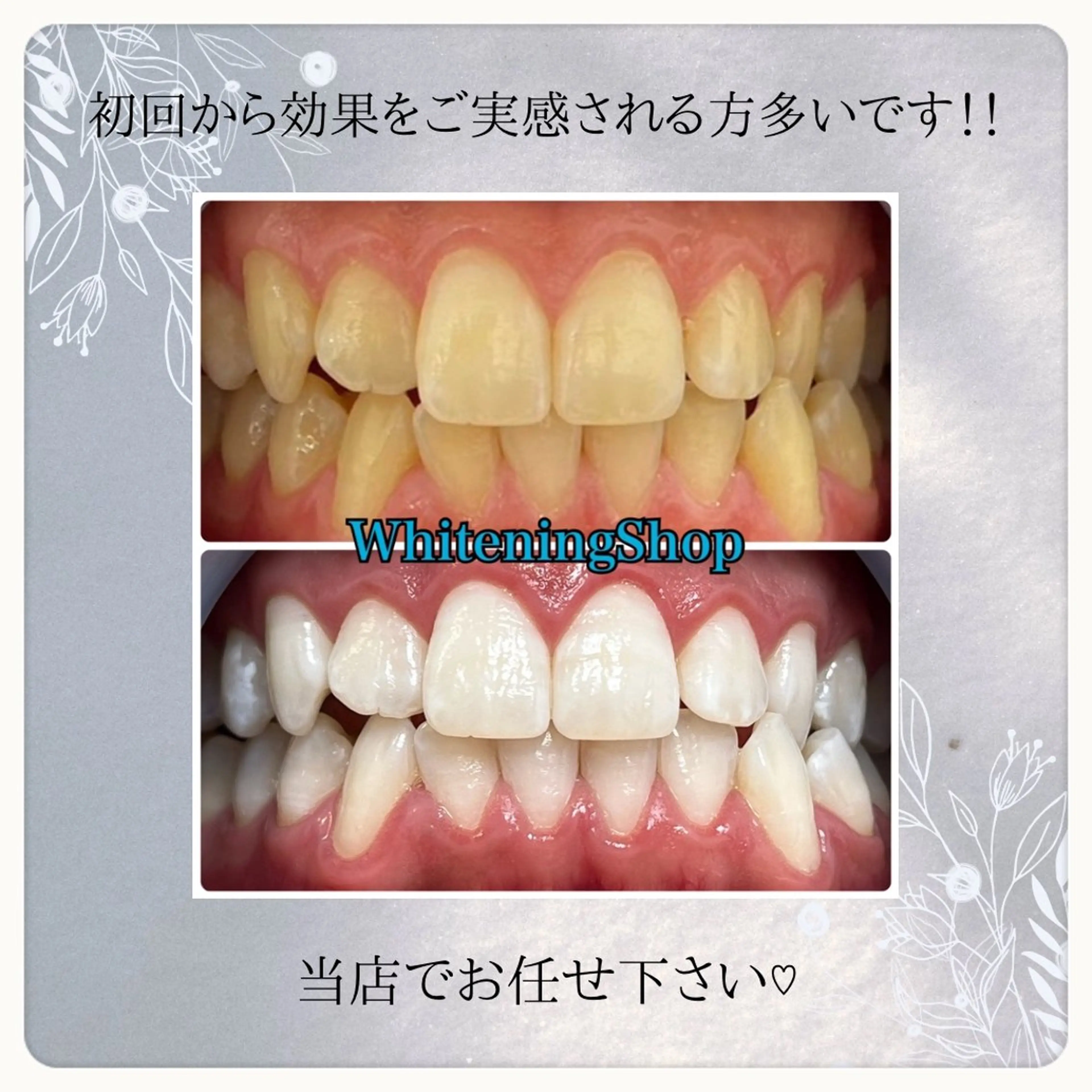 エステ リラク ホワイトニング ショップ吉祥寺店のエステ・リラクイメージ