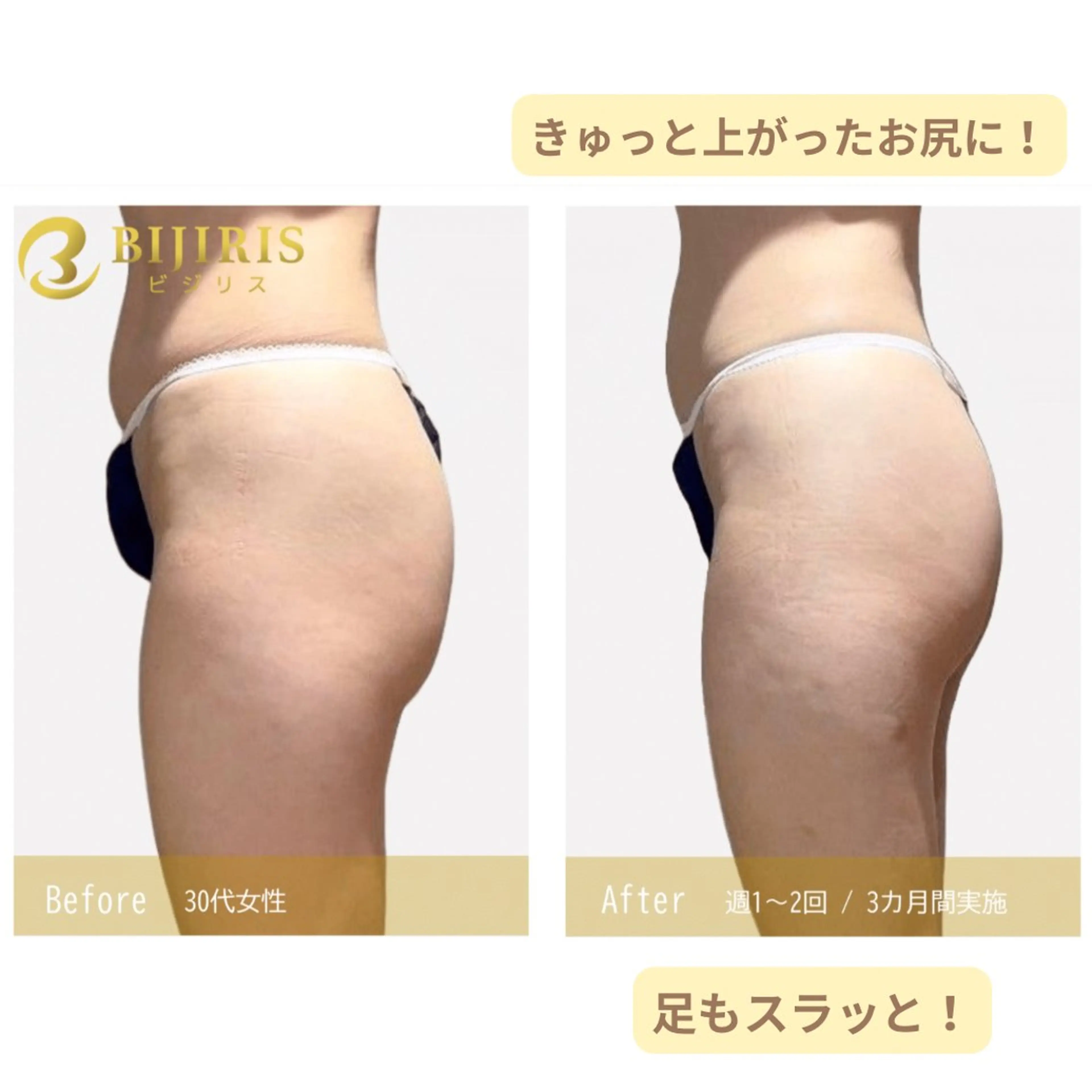 セルフ脱毛/美尻イス キングスサロン熊本のエステ・リラクイメージ