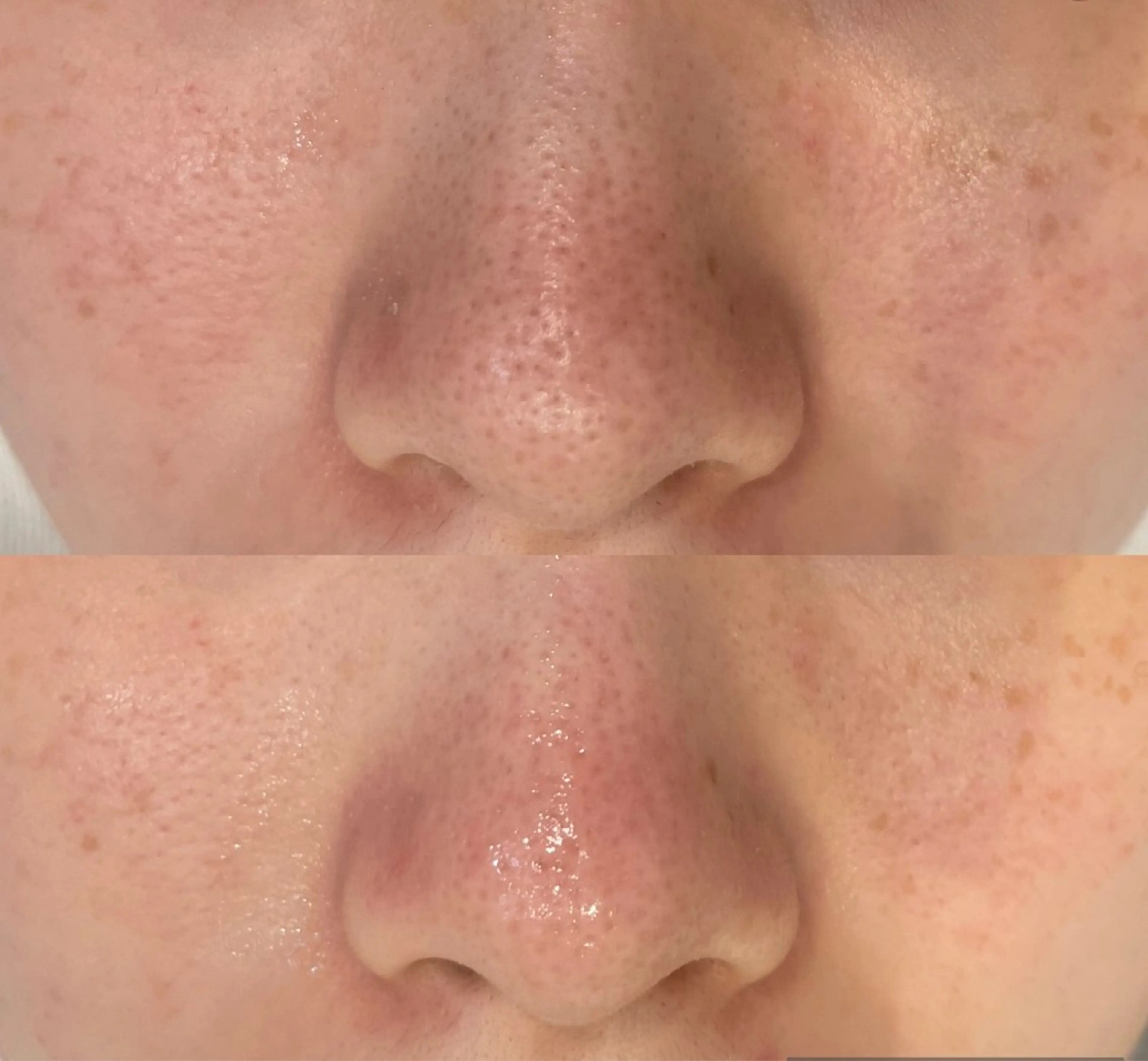 DeI'm   名古屋栄所属・小林 玲菜のエステ・リラクイメージ