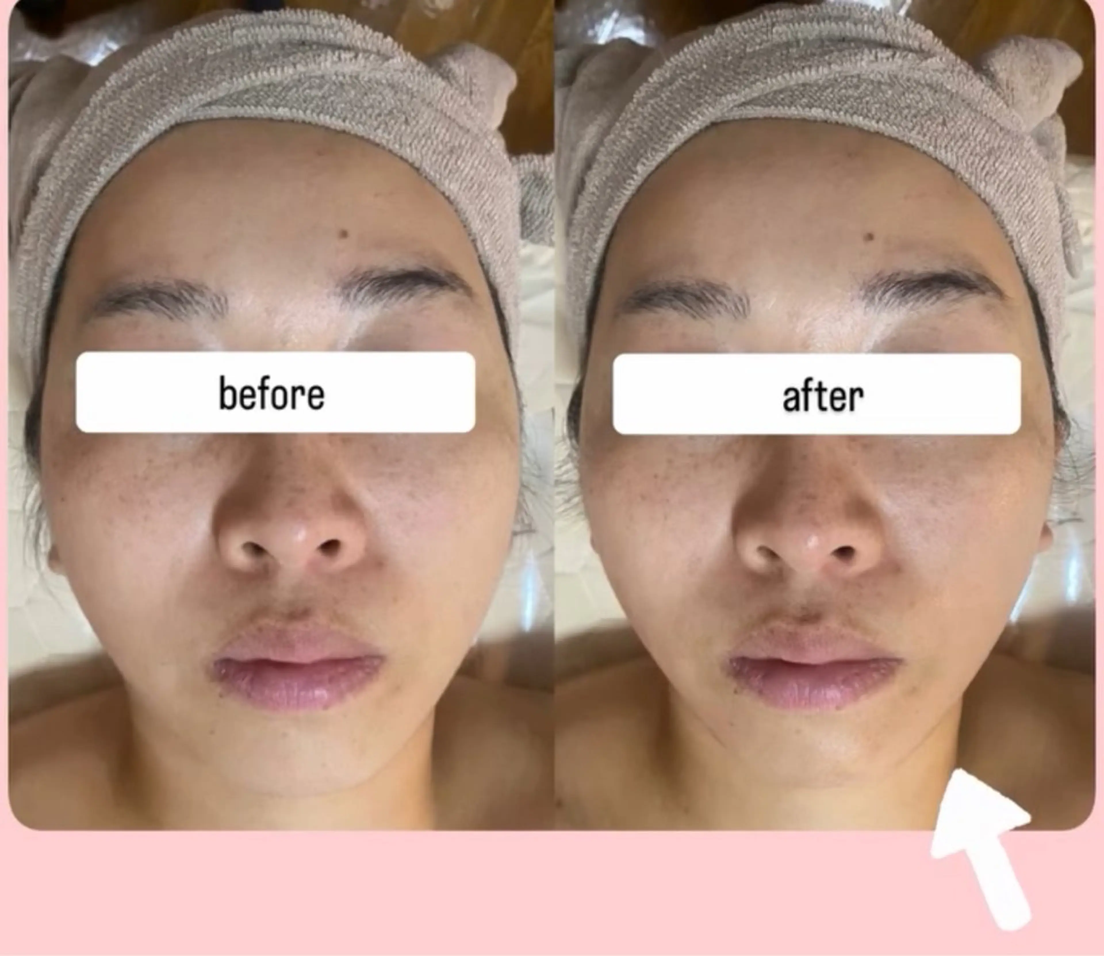 エステ ENOA所属・コルギ/全身リンパ saoriのエステ・リラクイメージ