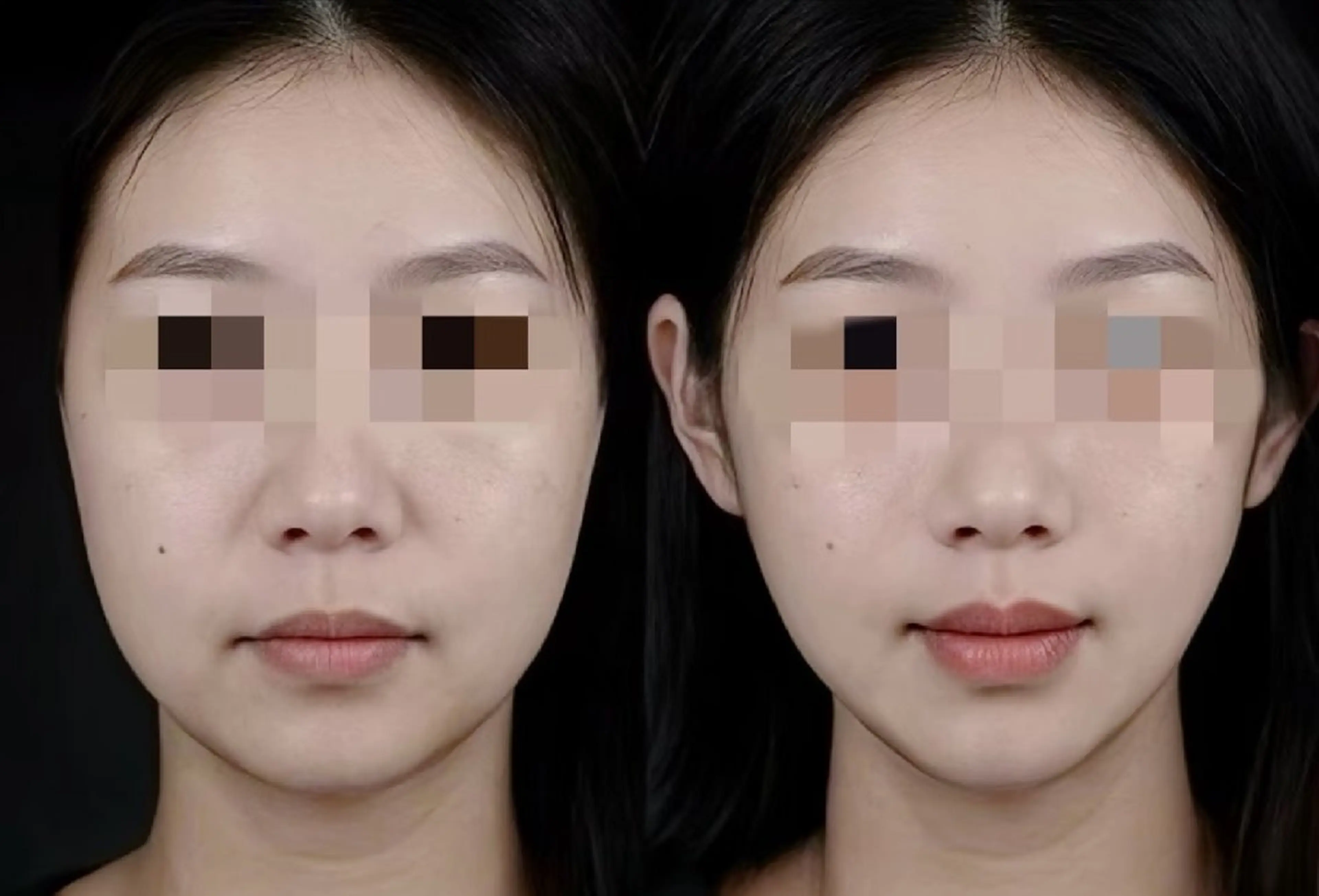 アイブロウ 眉毛ワックス脱毛 aliaハイフ&水光ジェットサロン所属・aliaハーブ水光店 エステティシャン募集のエステ・リラクイメージ