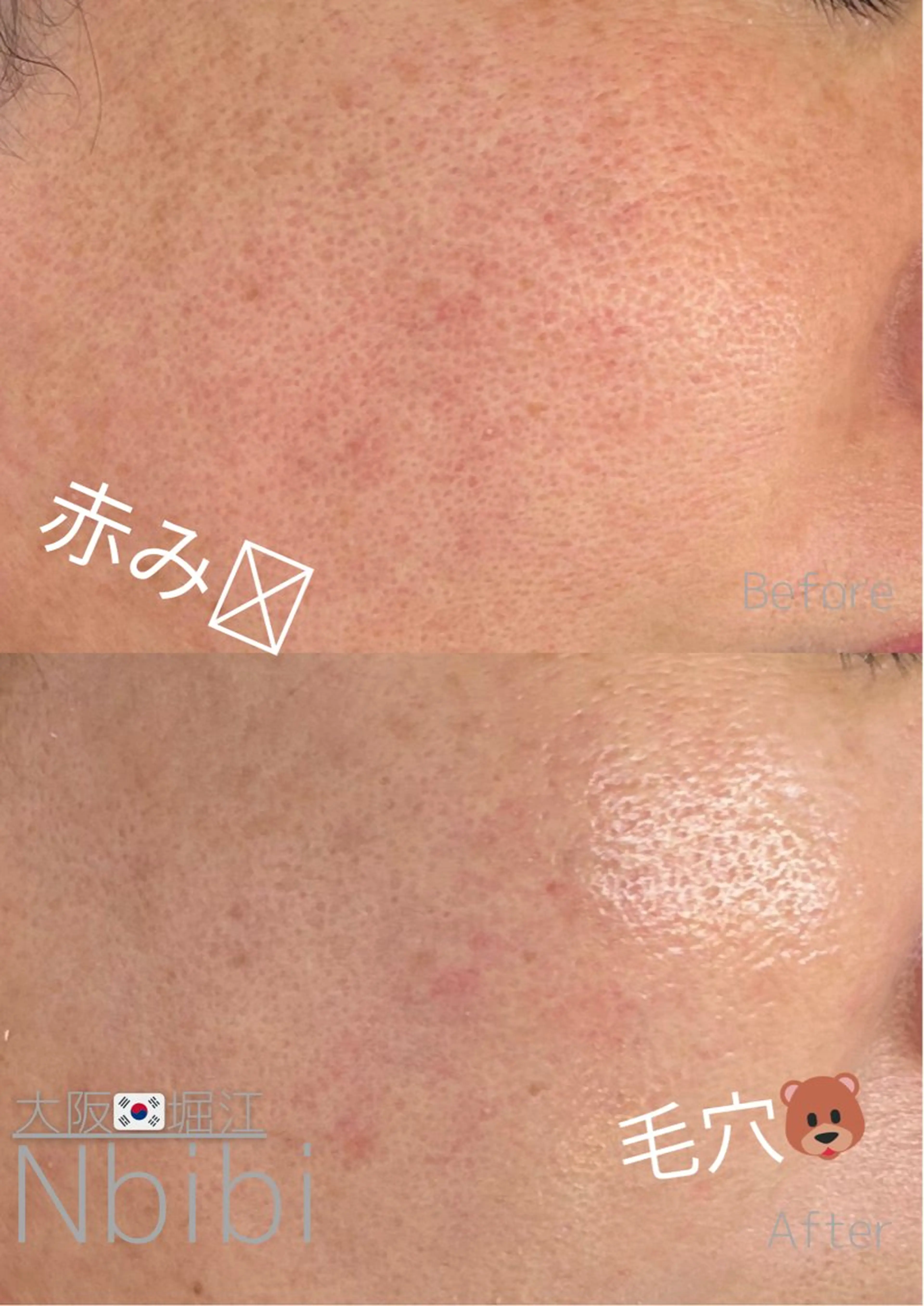 エステ 韓国🇰🇷価格 サロン_Nbibiのエステ・リラクイメージ