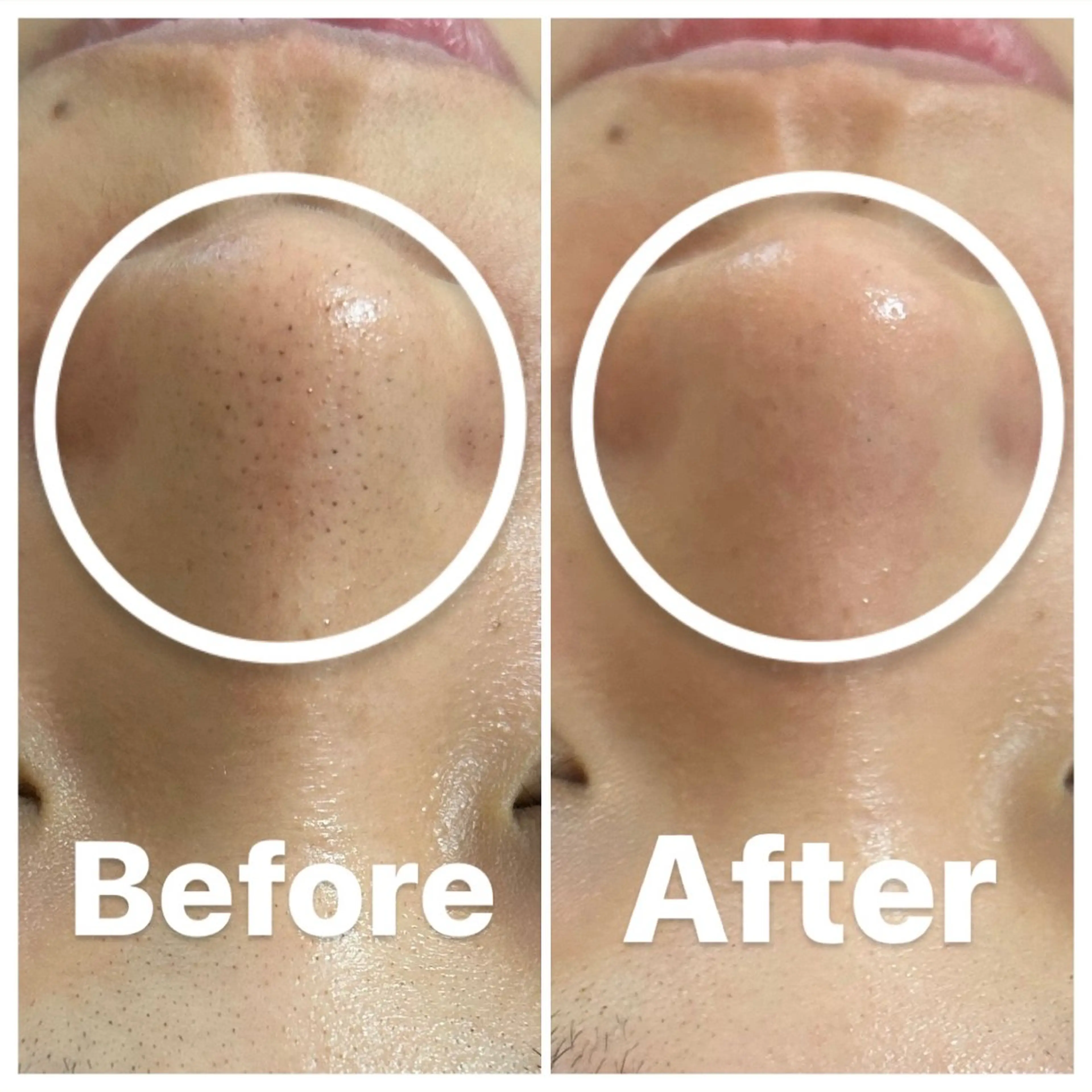 肌質改善・小顔サロン 20代店長RINNAのエステ・リラクイメージ